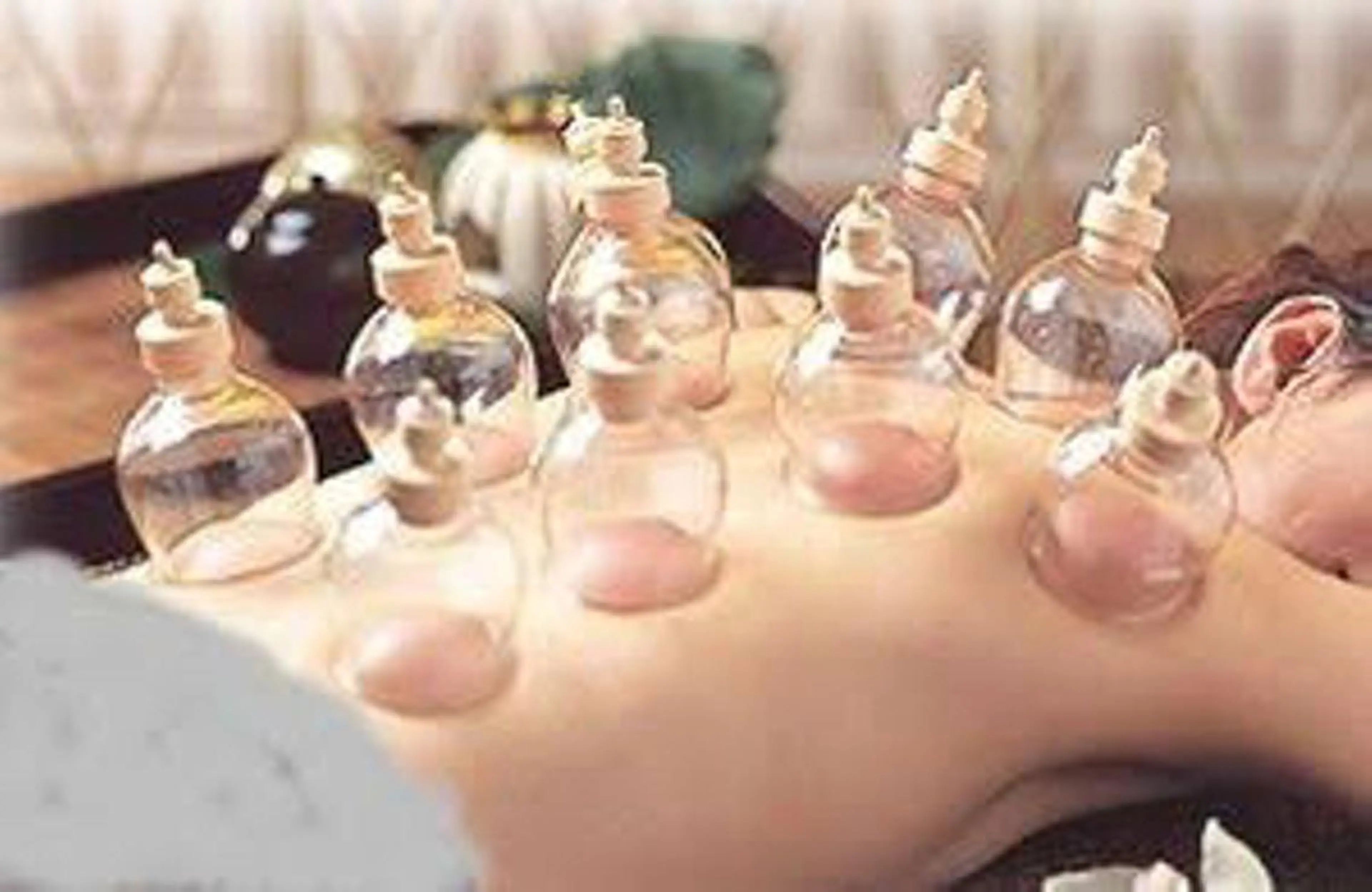 【口コミ💬】カッピング×アロマ 120min(FB付)の写真