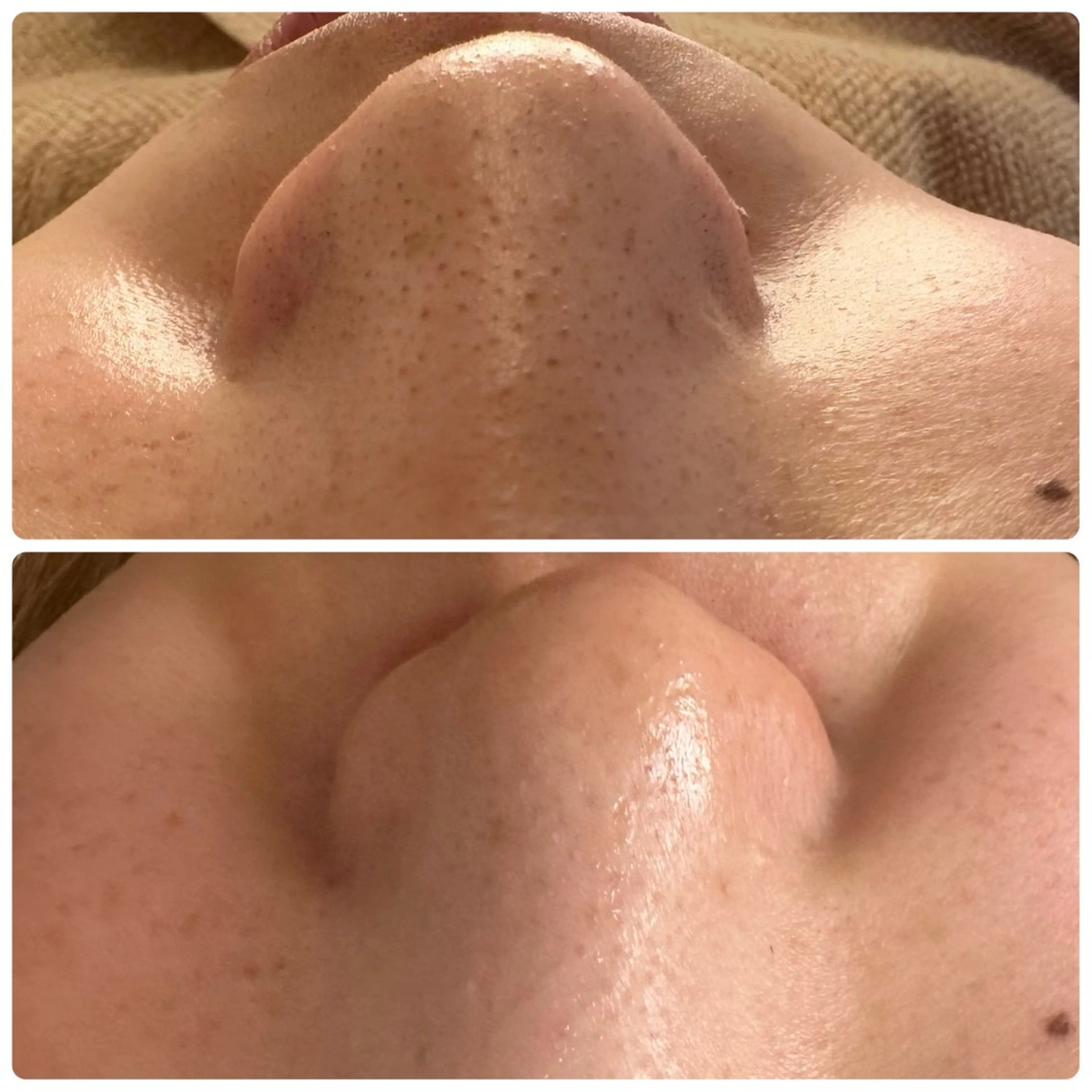 エステ バストアップ専門/デ トックス/小顔コルギのエステ・リラクイメージ