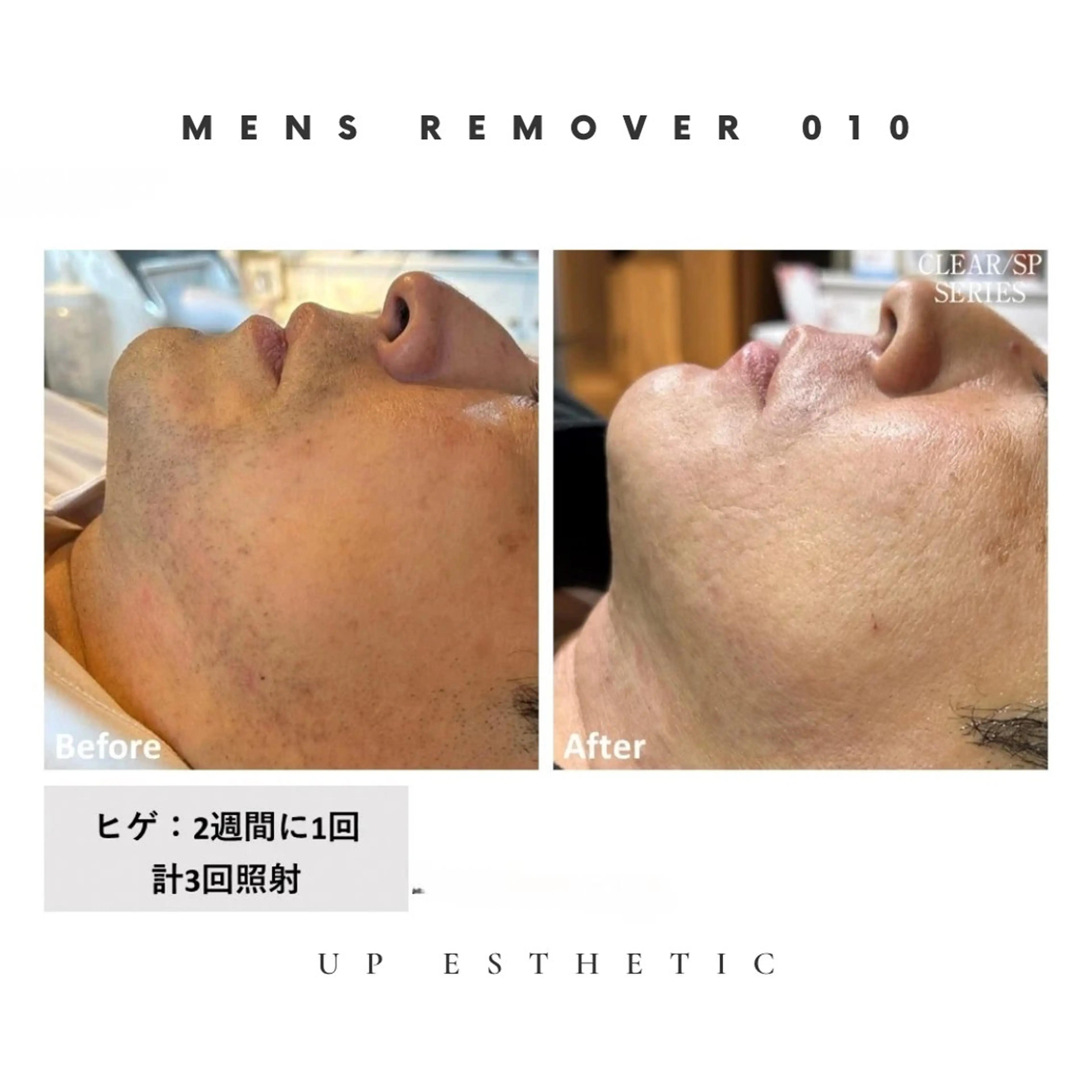 メンズ 脱毛 ウプエステティック所属・韓国肌管理 ウプエステティックのエステ・リラクイメージ