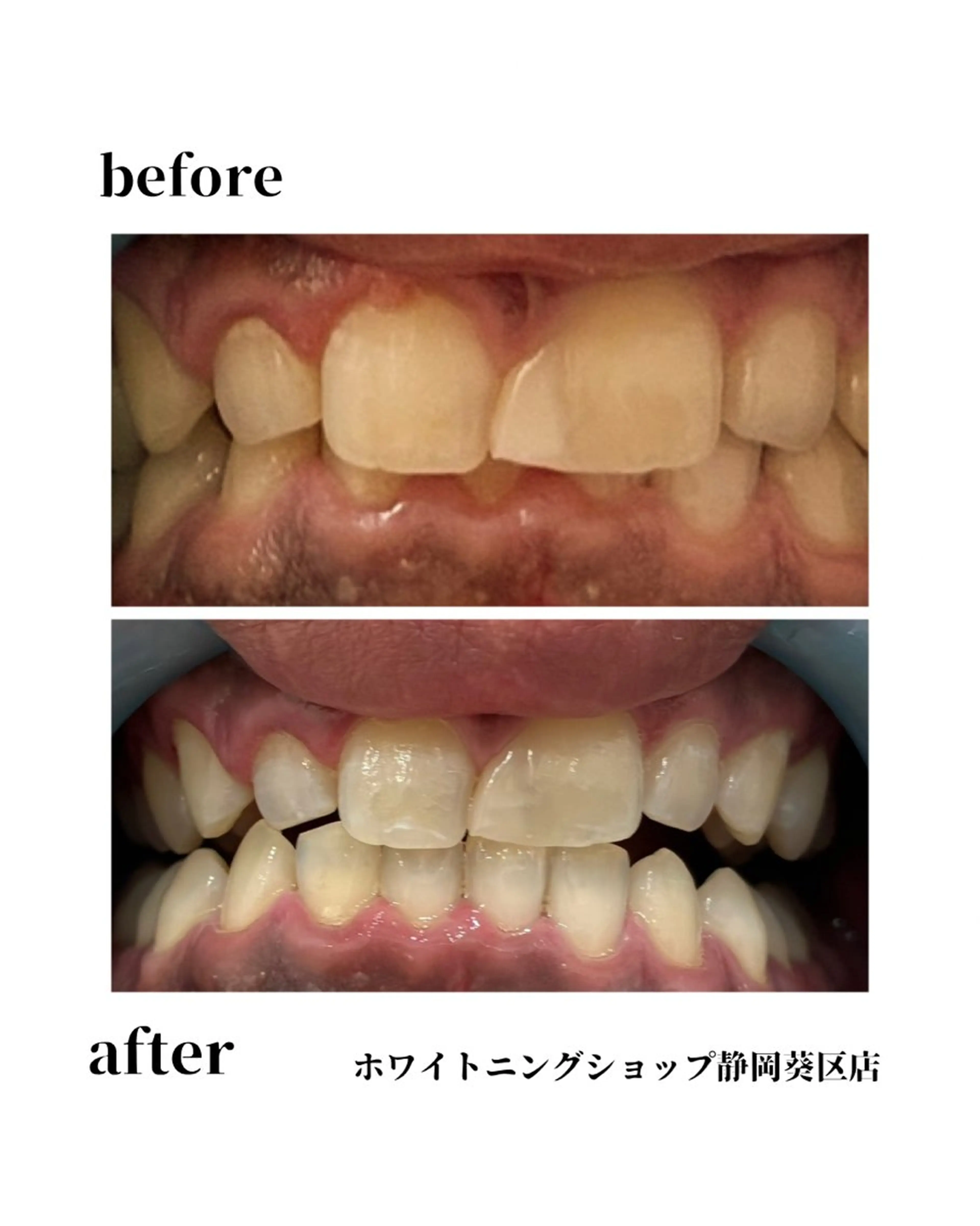 ホワイトニング ショップ葵区静岡駅店のその他イメージ