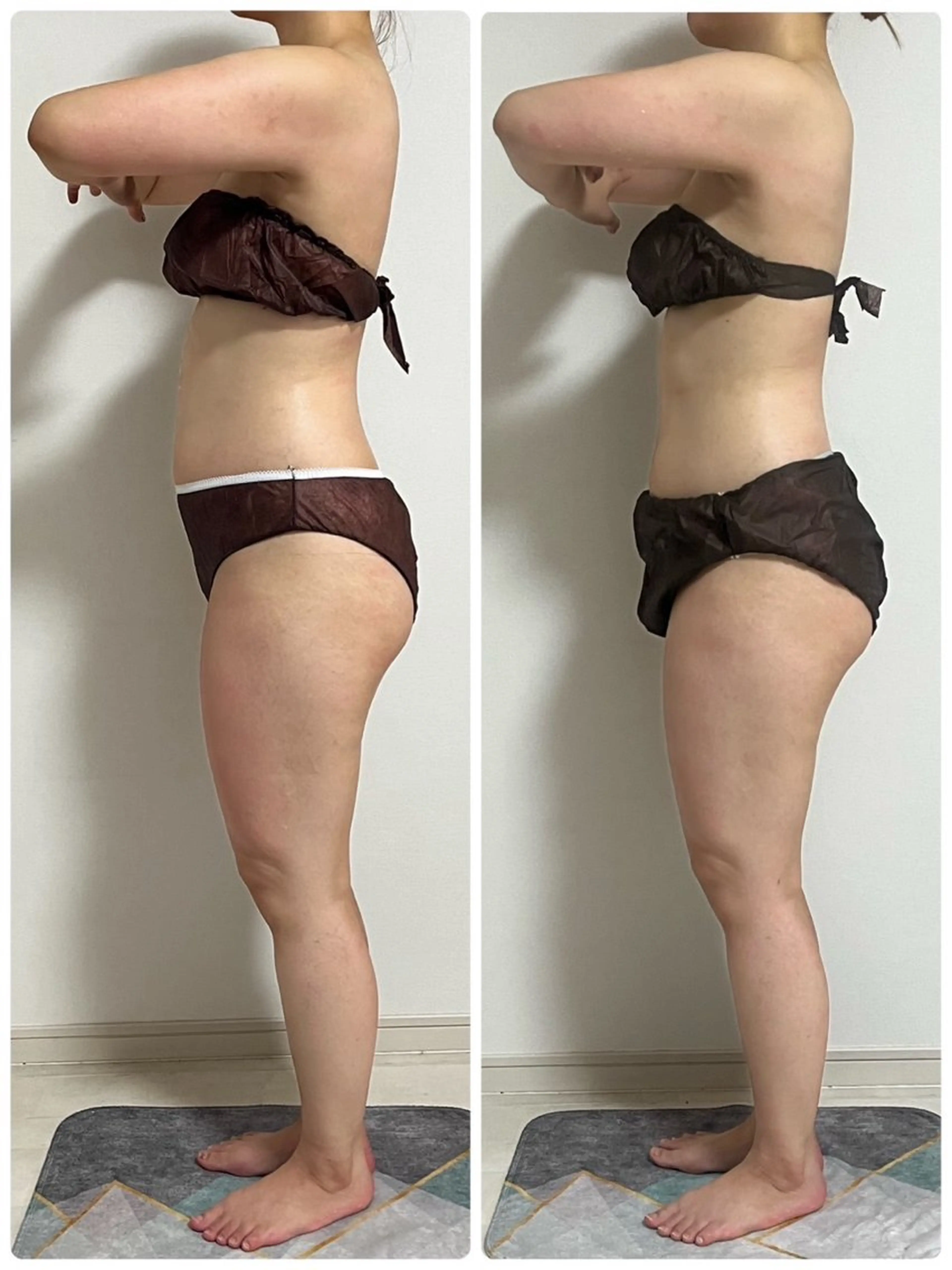 心斎橋痩身ダイエット 韓国.美容鍼.小顔のエステ・リラクイメージ