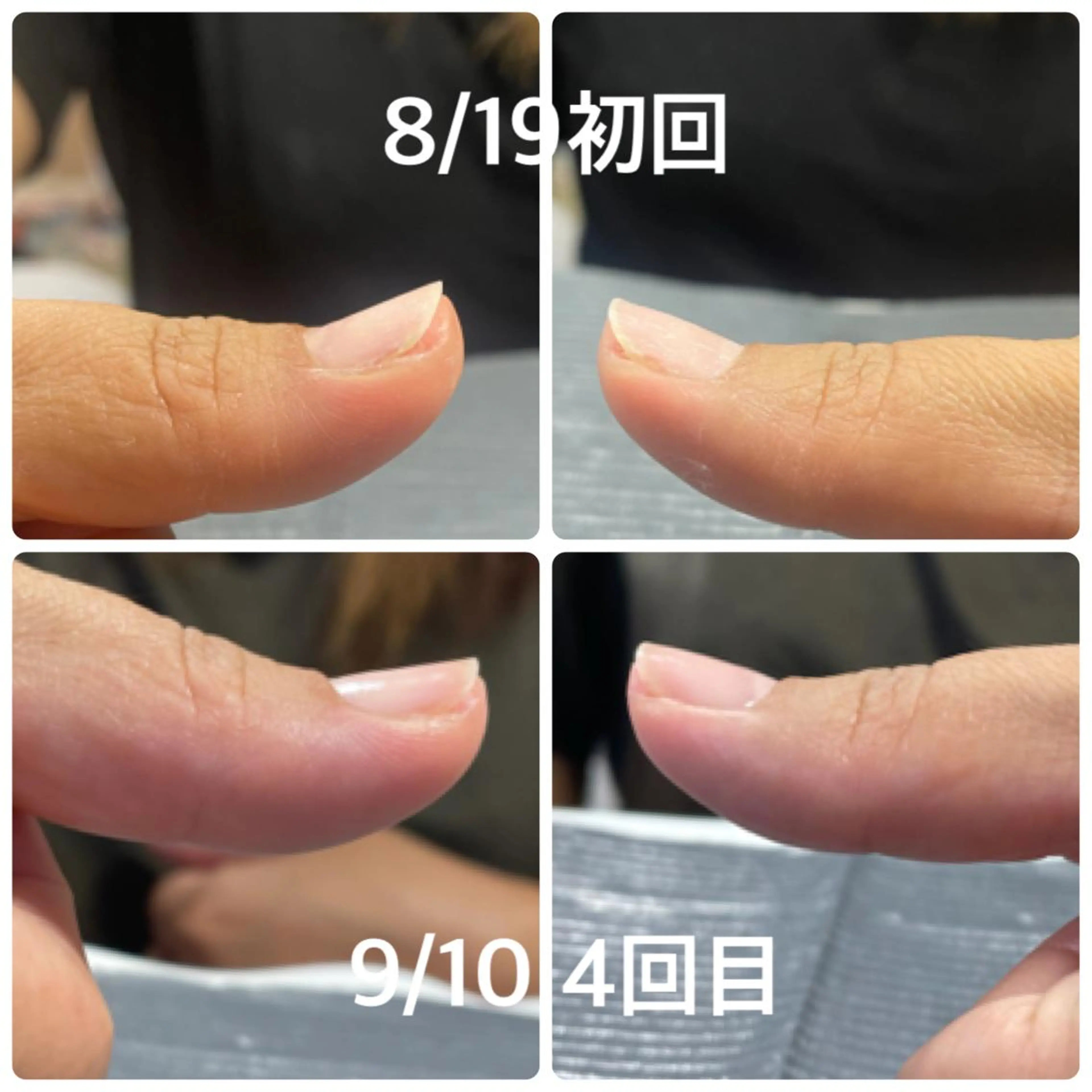 ネイル 奥園 良恵のネイルデザイン