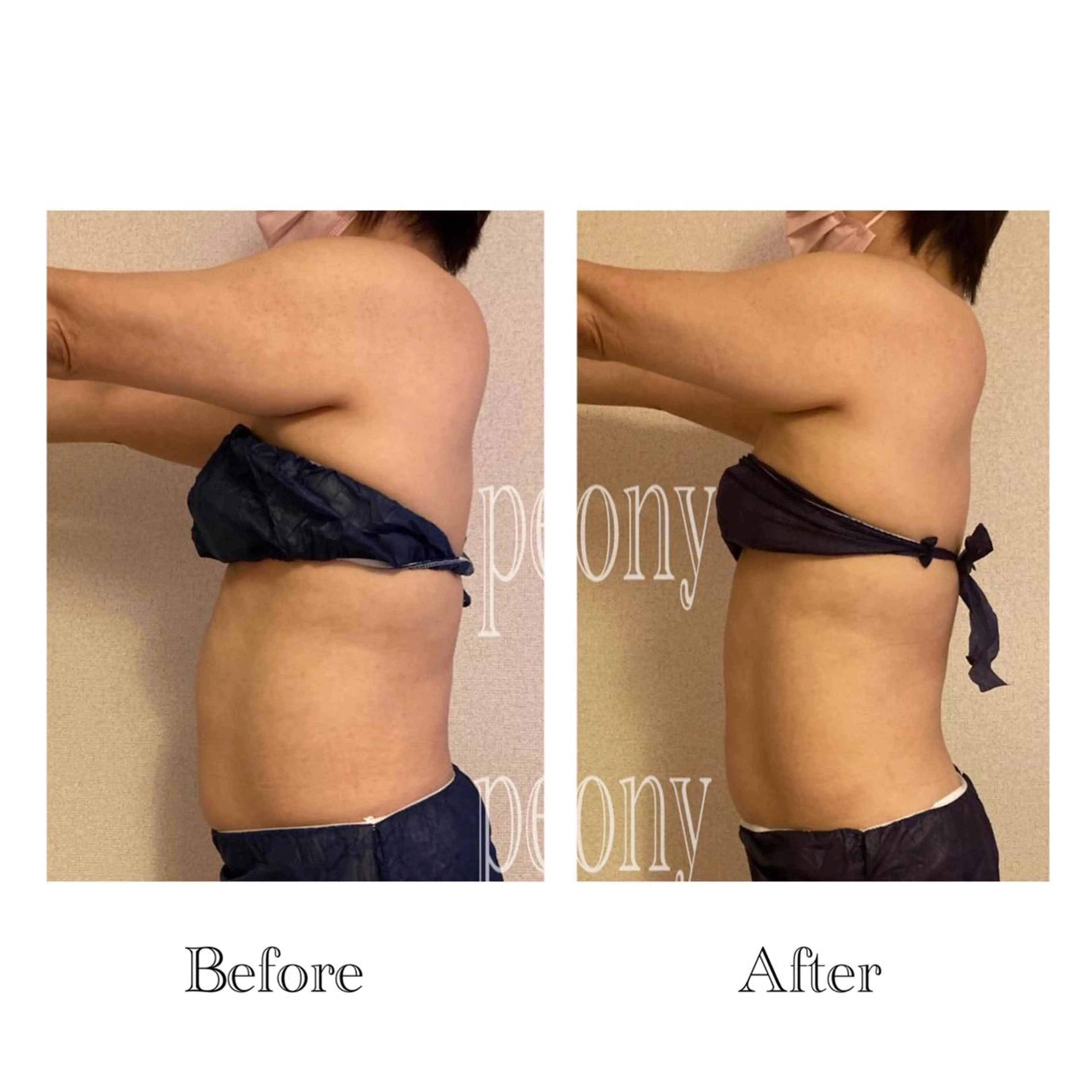 エステ デトックス美容専門 サロンｐｅｏｎｙのエステ・リラクイメージ