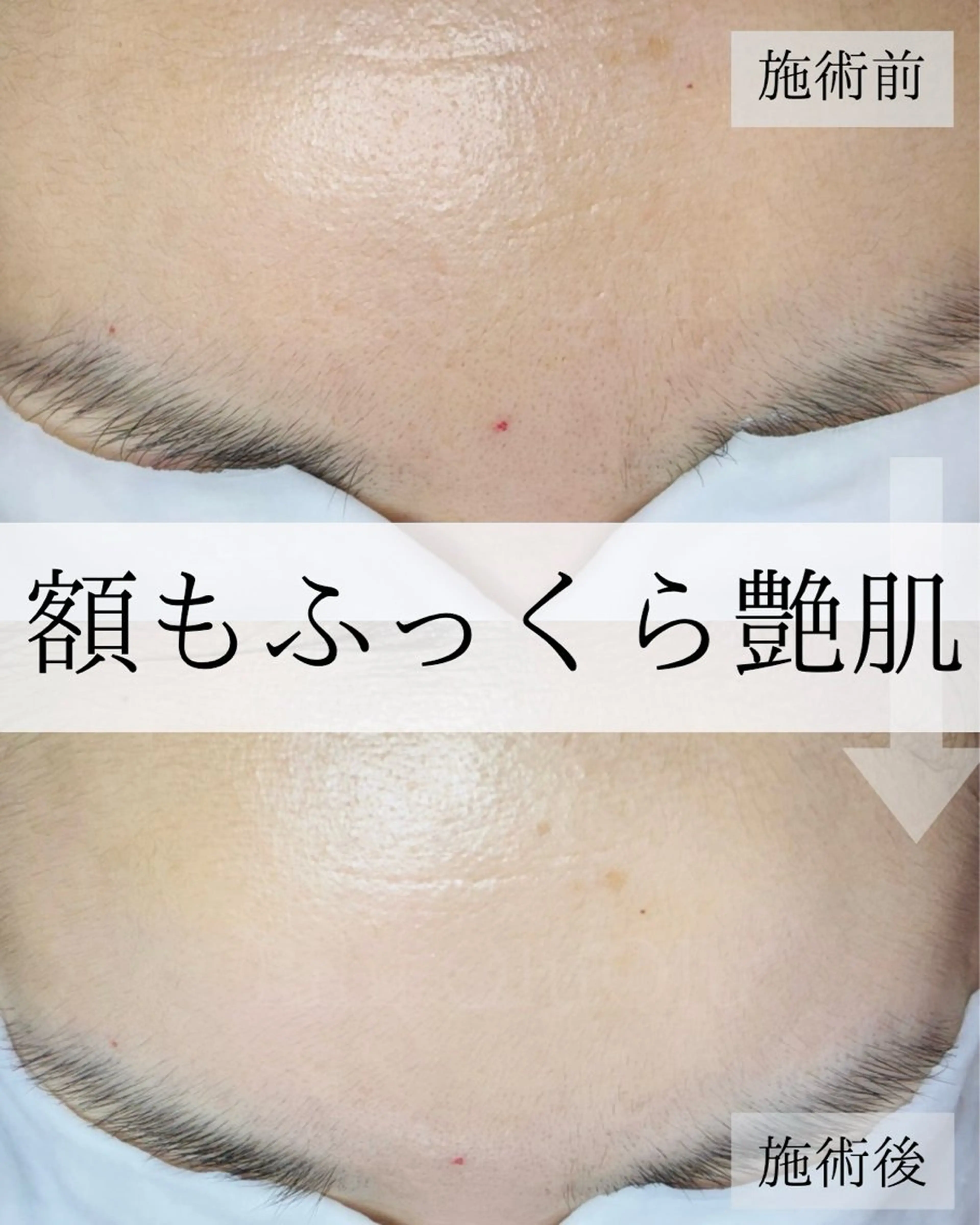 毛穴汚れ改善専門店/ 岸和田/リヒオルオルのエステ・リラクイメージ