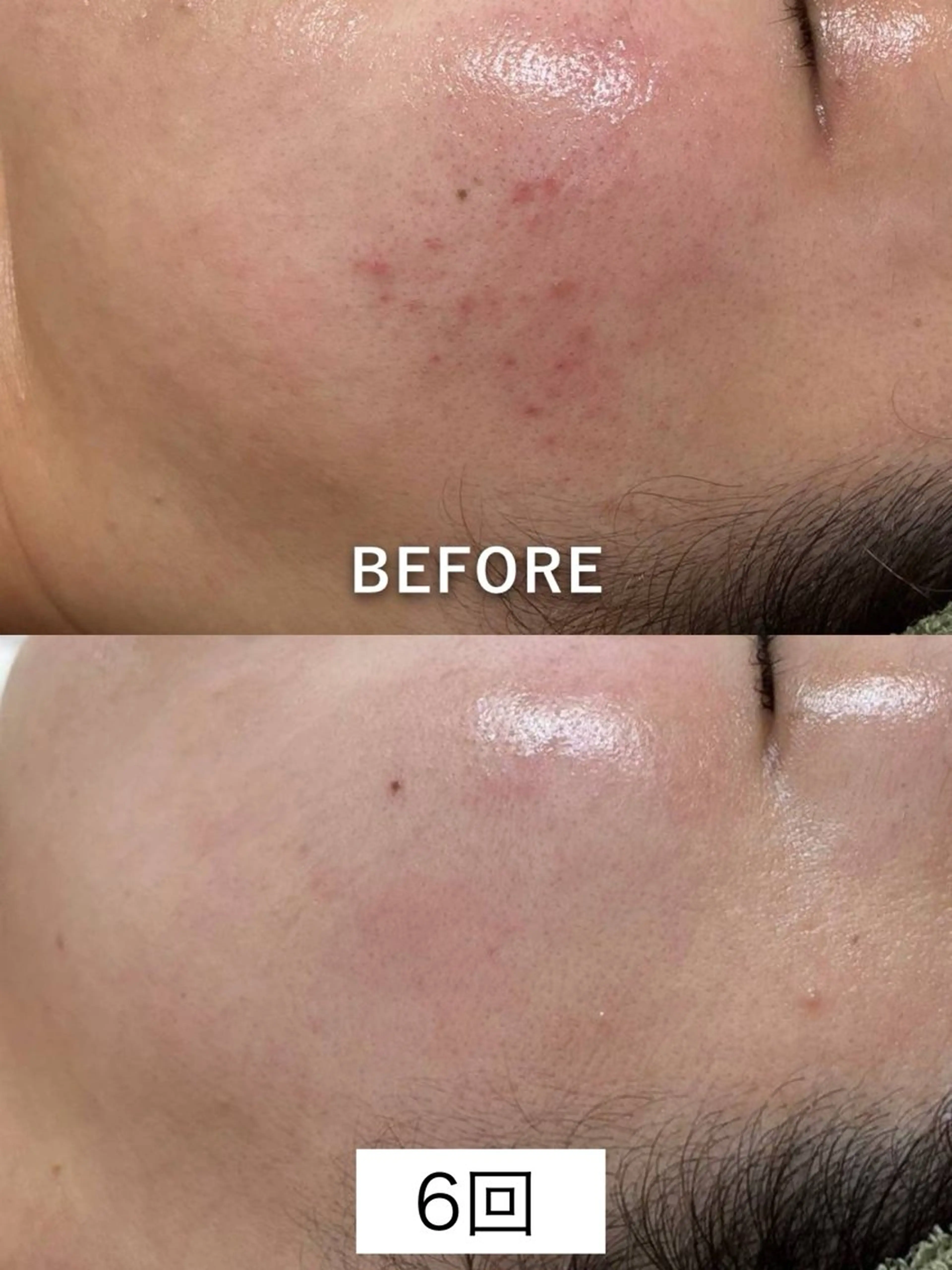 エステ 韓国美肌/肌質改善 【天神】のエステ・リラクイメージ