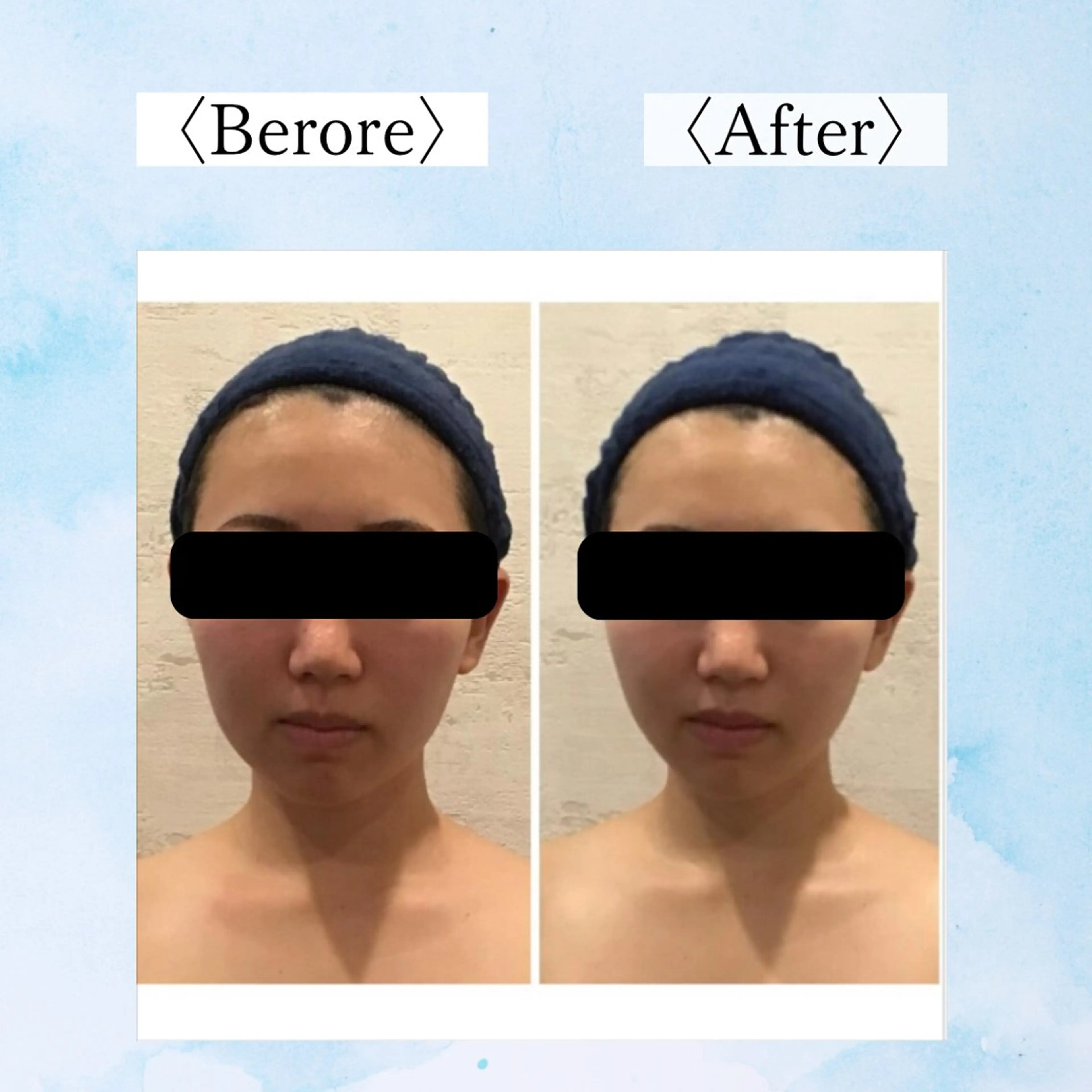 小顔フェイスラボ 新潟のエステ・リラクイメージ