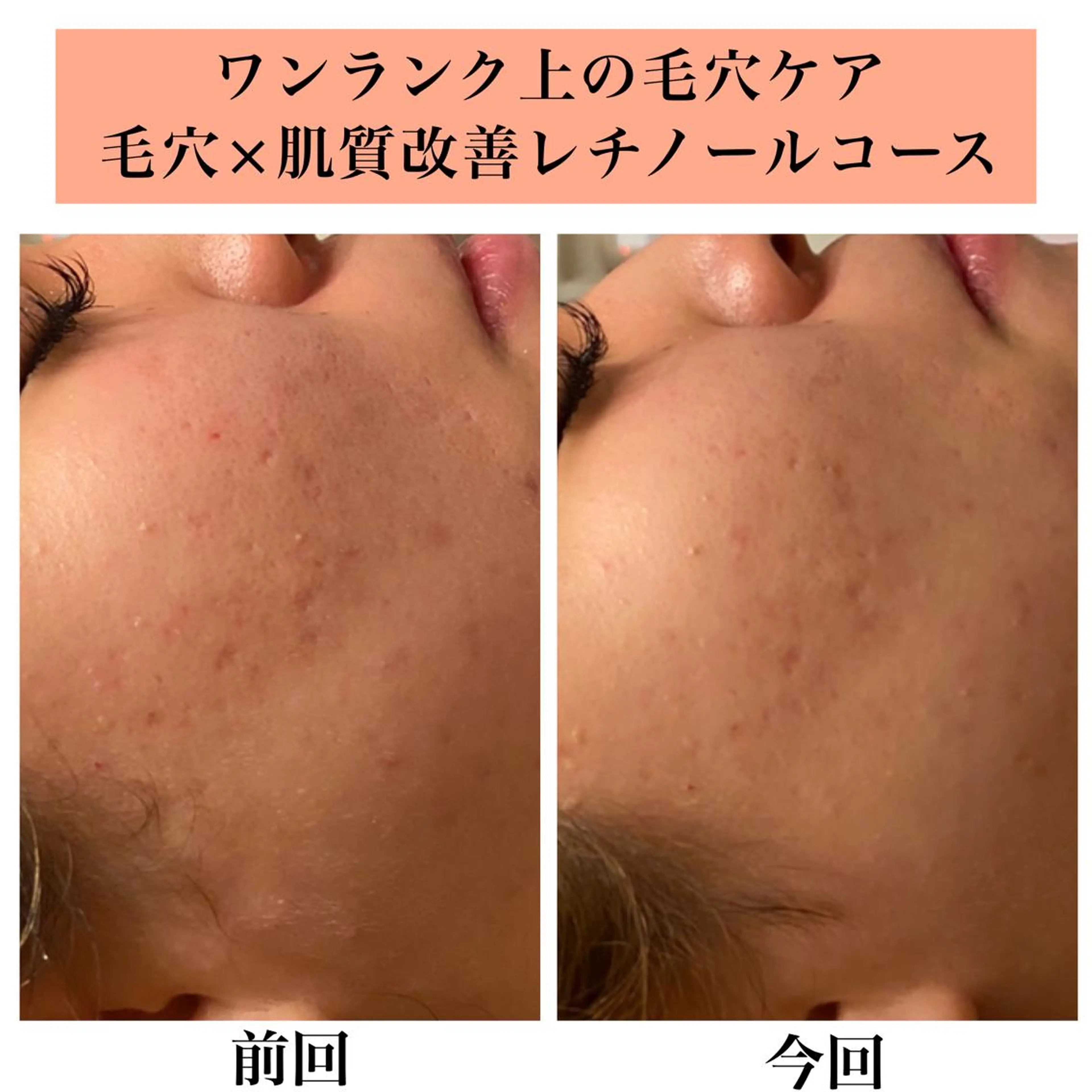 エステ リラク Bellesthe （ベルエステ）のエステ・リラクイメージ