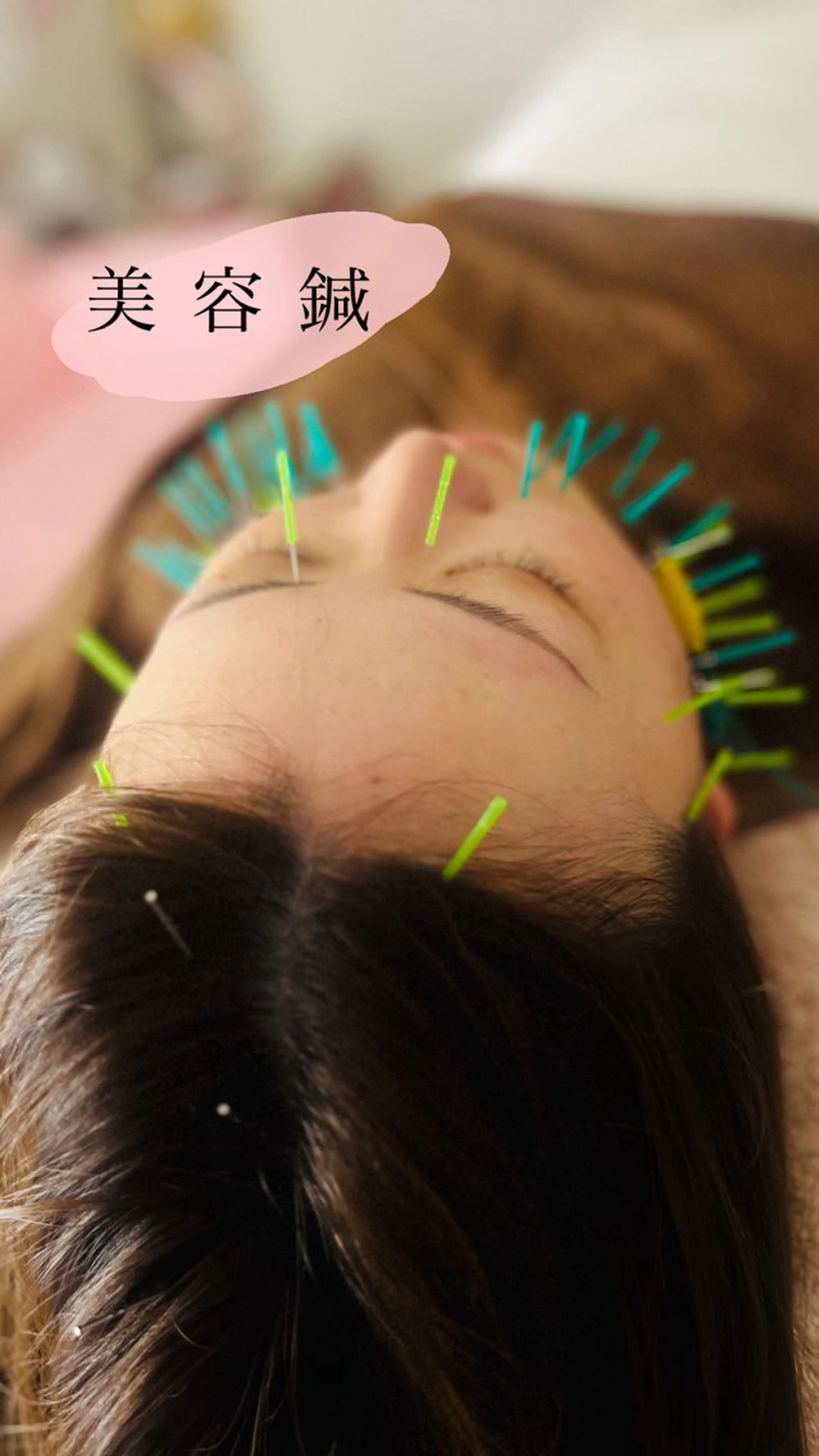 エステ アロマ･美容鍼･カッ ピング「麗」鍼灸院のエステ・リラクイメージ