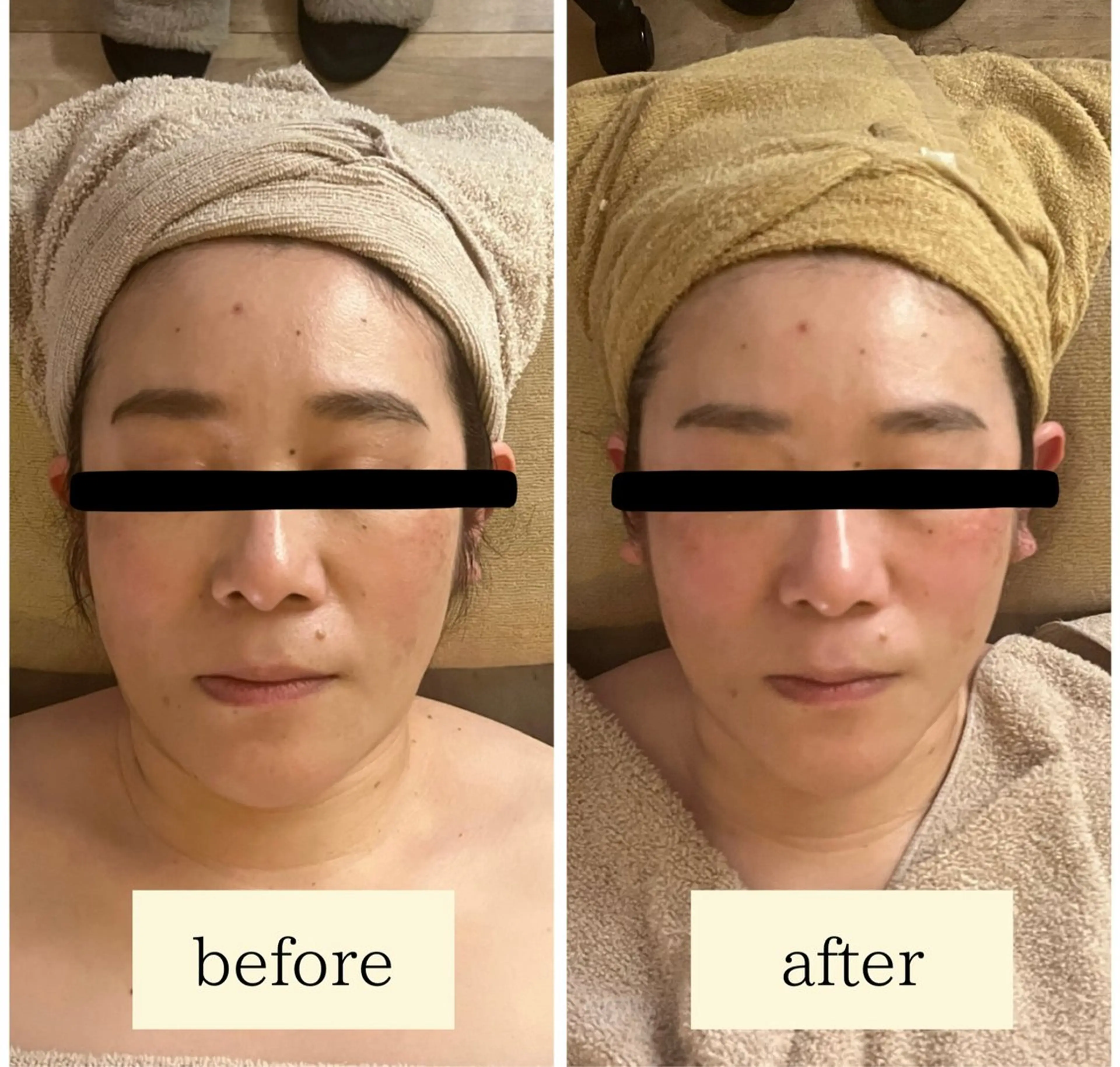 【お顔の悩み解消】コルギフェイシャル（モデリングマスク付き）70分の写真