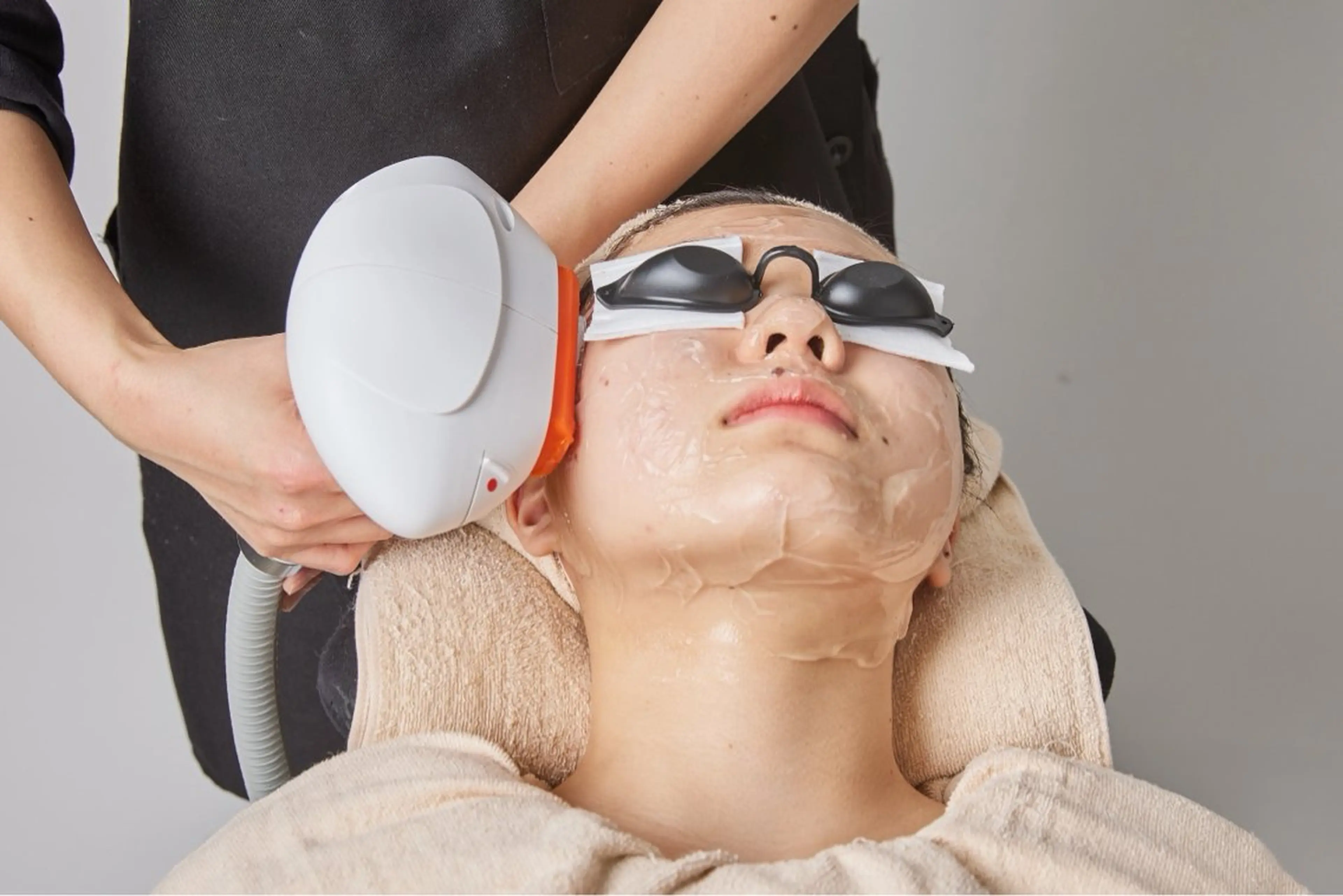 エステシェービング×お顔の脱毛（5/1​〜​予約可能）の写真