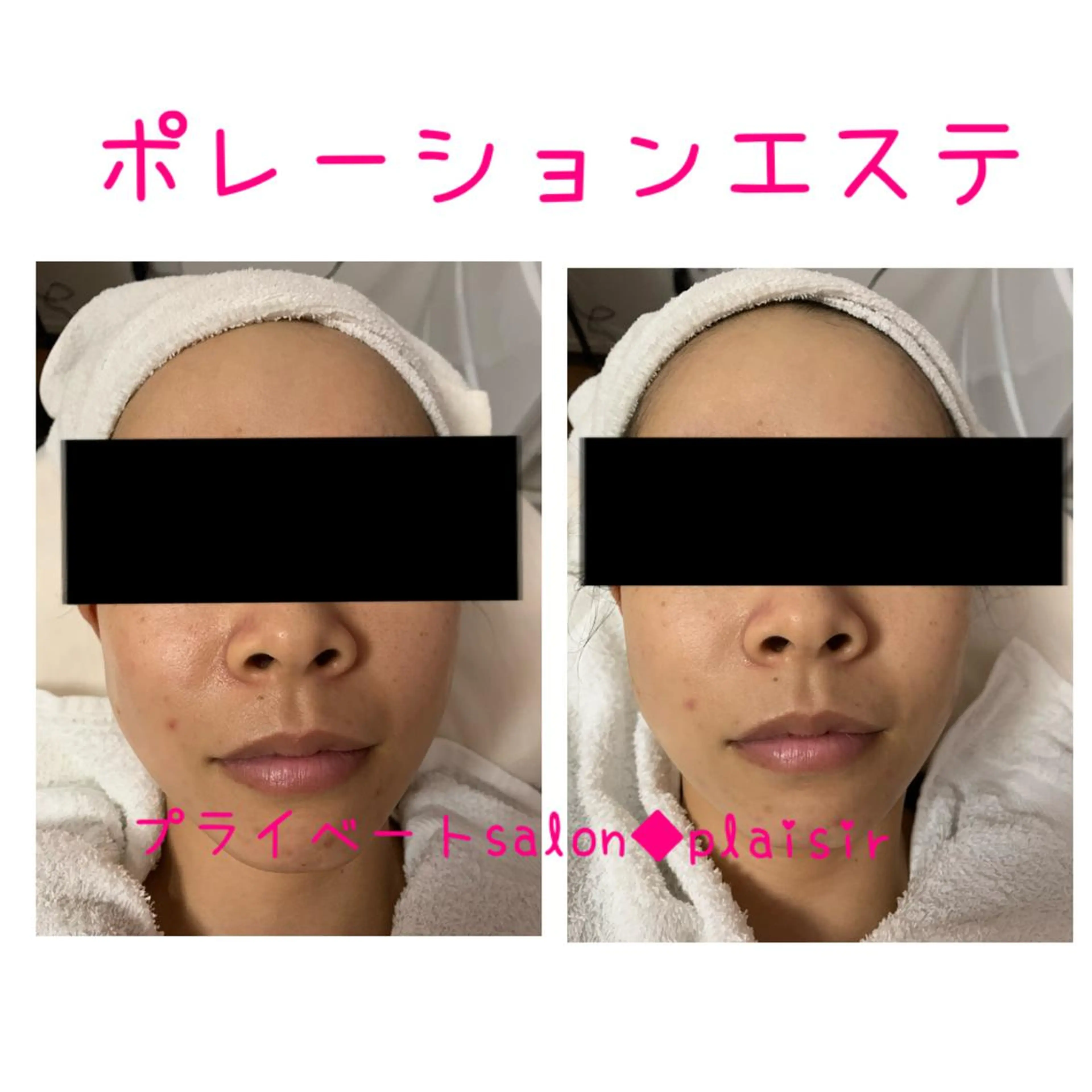 エステ De I'm 可児店のエステ・リラクイメージ