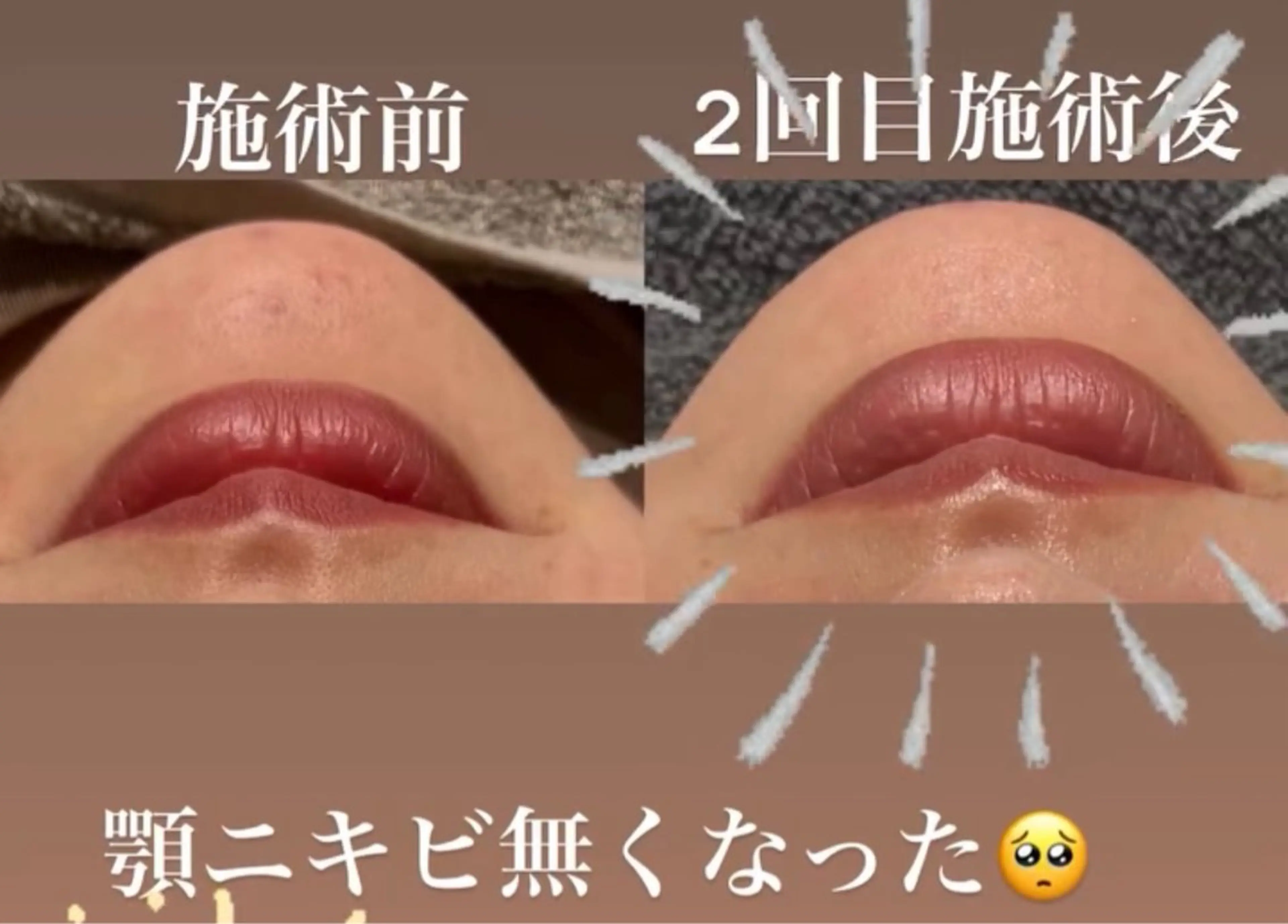 Esthetic ReTweetのエステ・リラクイメージ