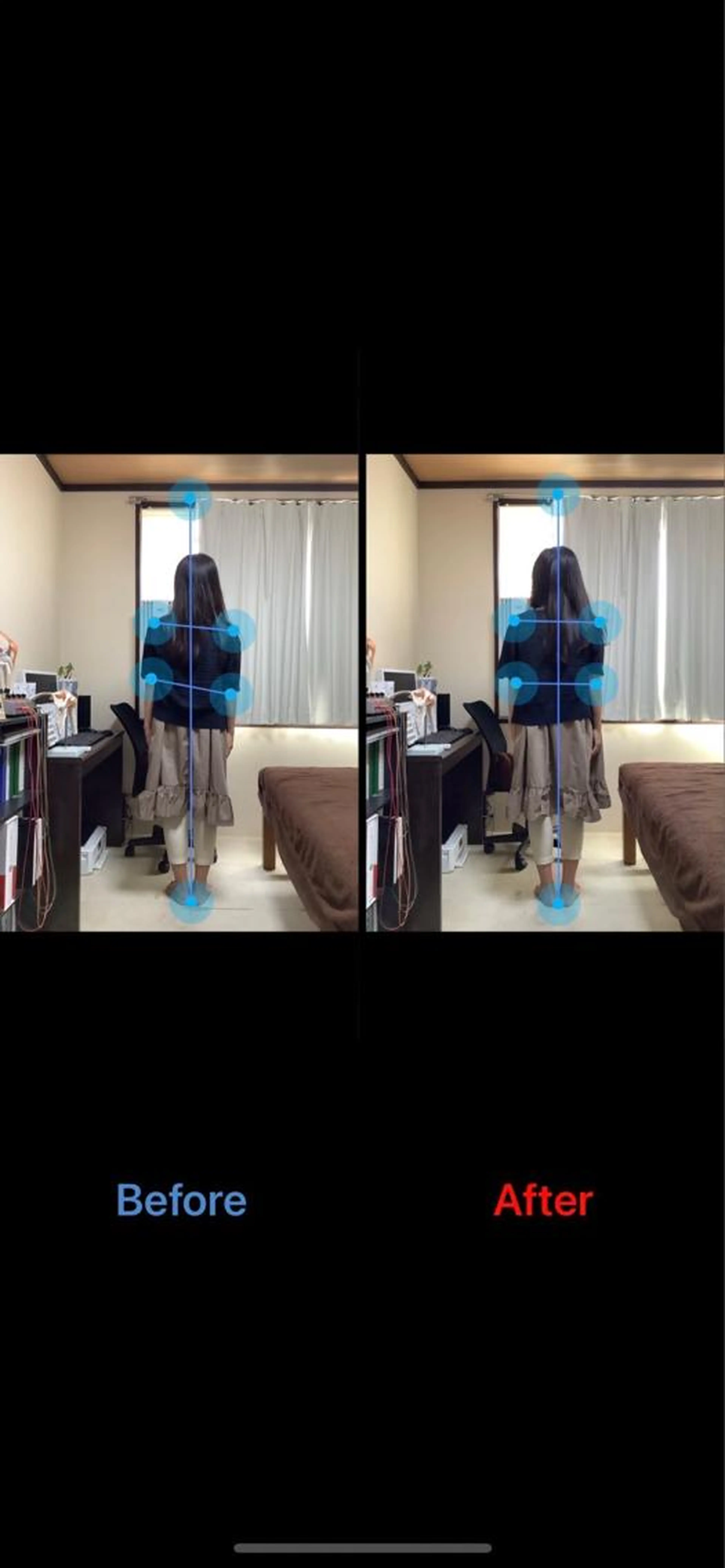 姿勢調整施術の写真