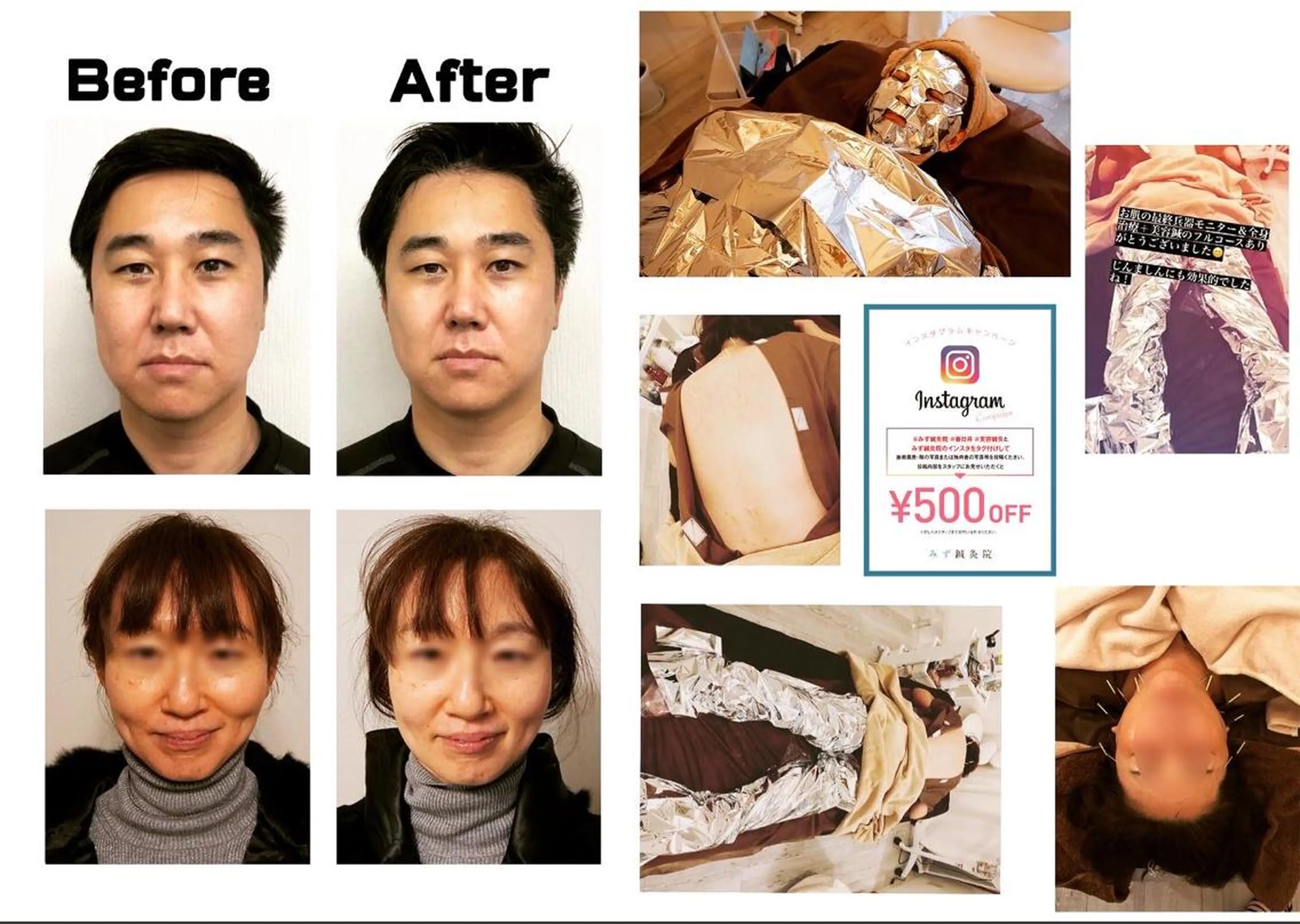 その他 水島 秀輝（美容鍼灸師）のその他イメージ