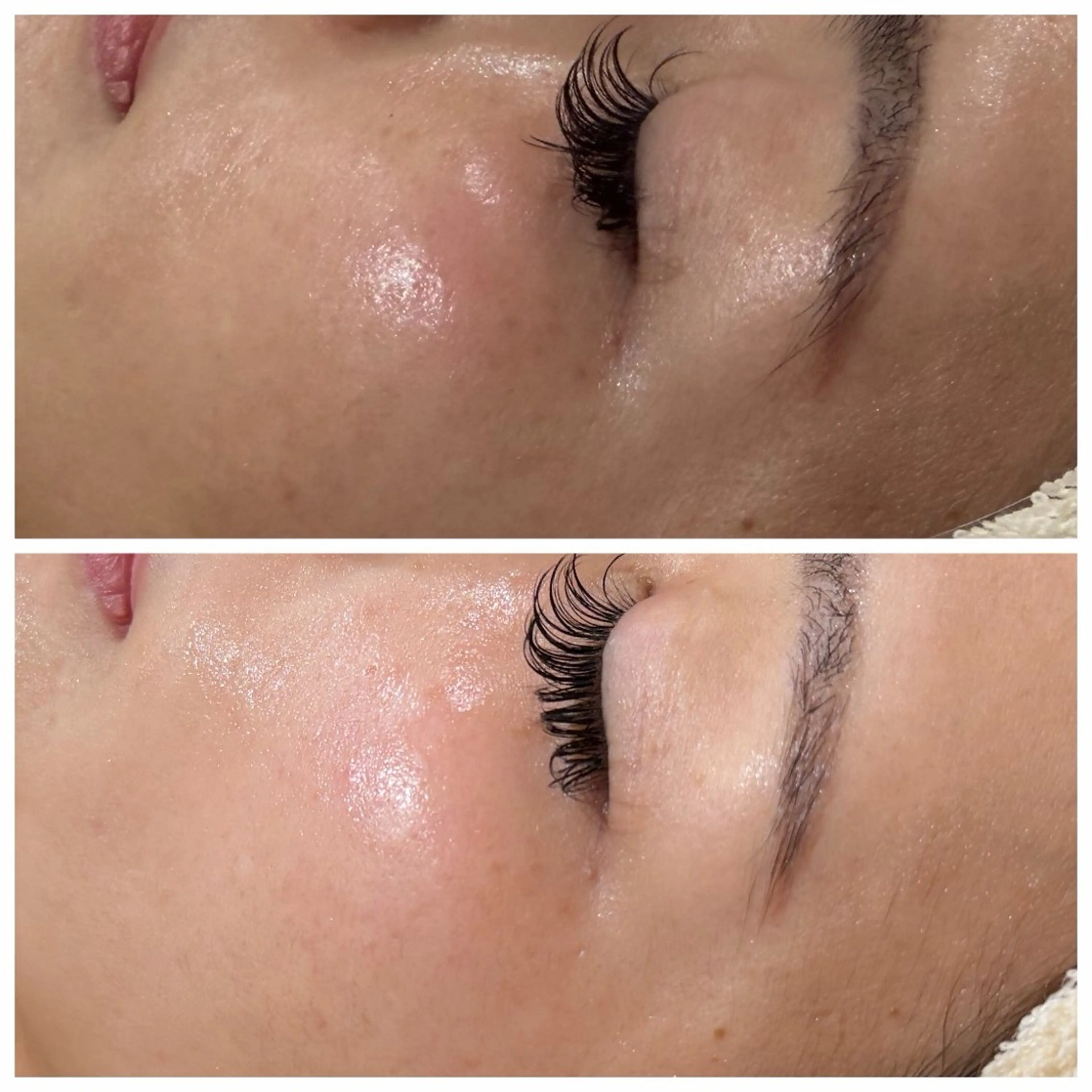 エステ Raviy 【痩身・韓国肌管理】のエステ・リラクイメージ