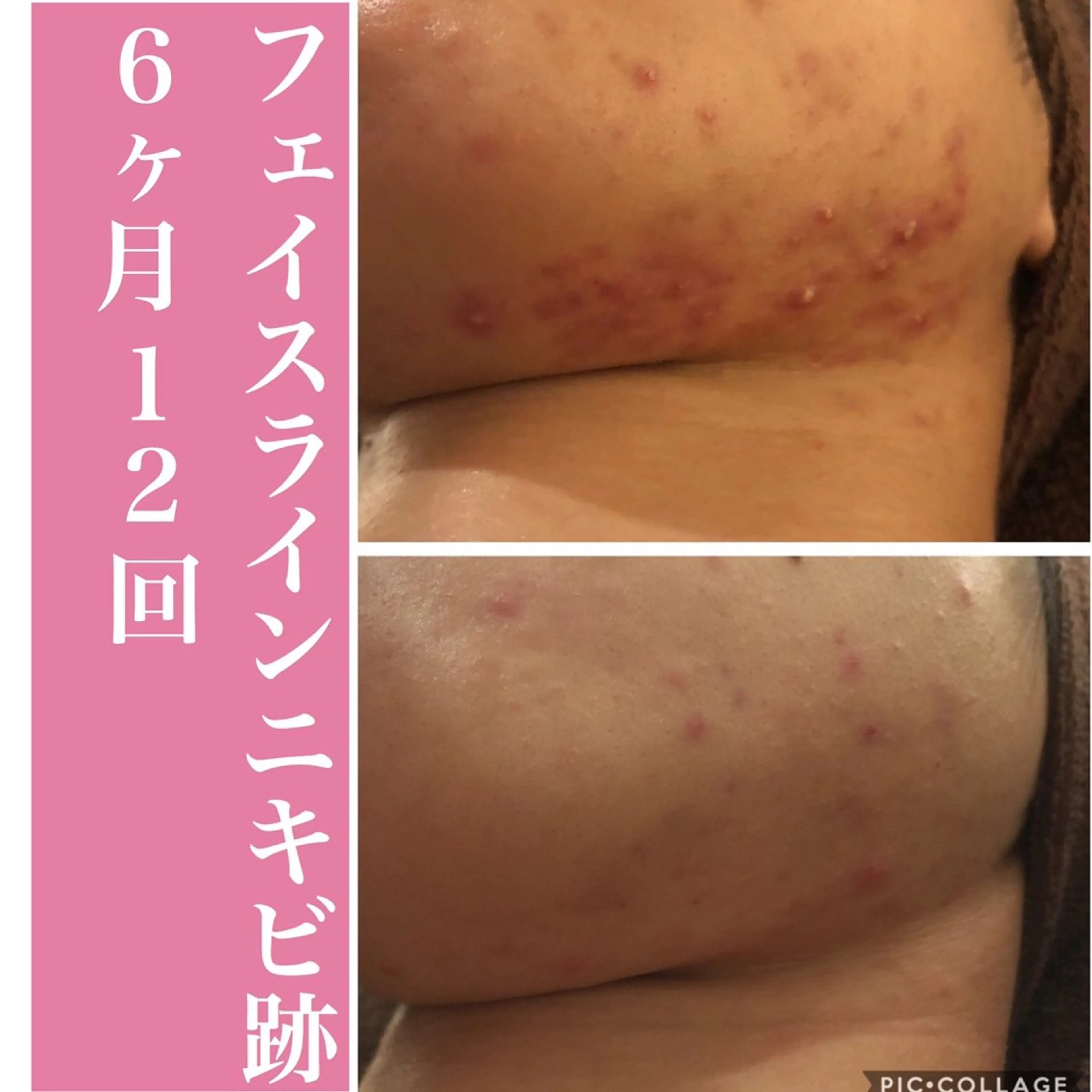 エステ リラク ニキビ・肌質改善専門 ♡人生が変わるサロンのエステ・リラクイメージ