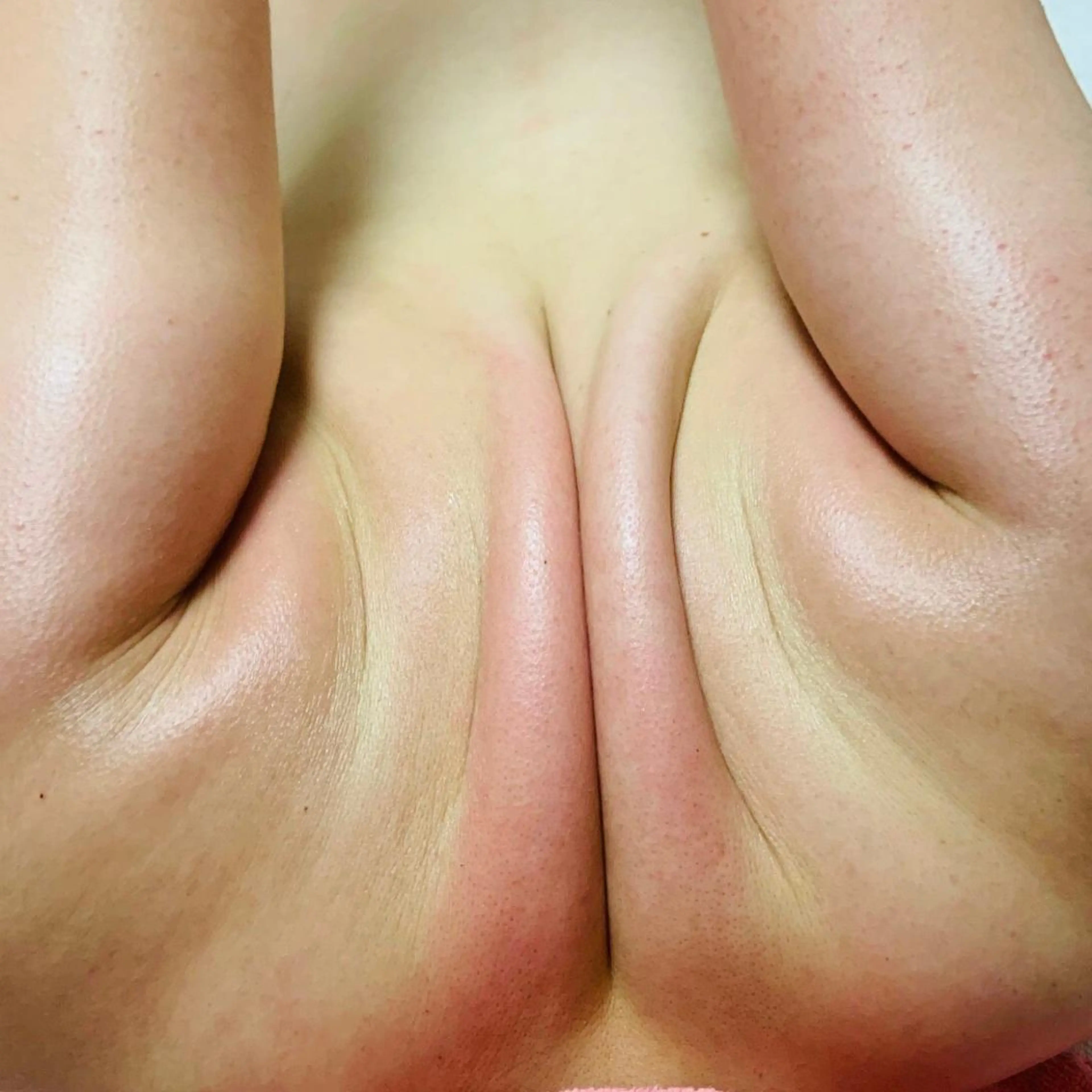 Linomalie エステ/たるみ/脱毛のエステ・リラクイメージ