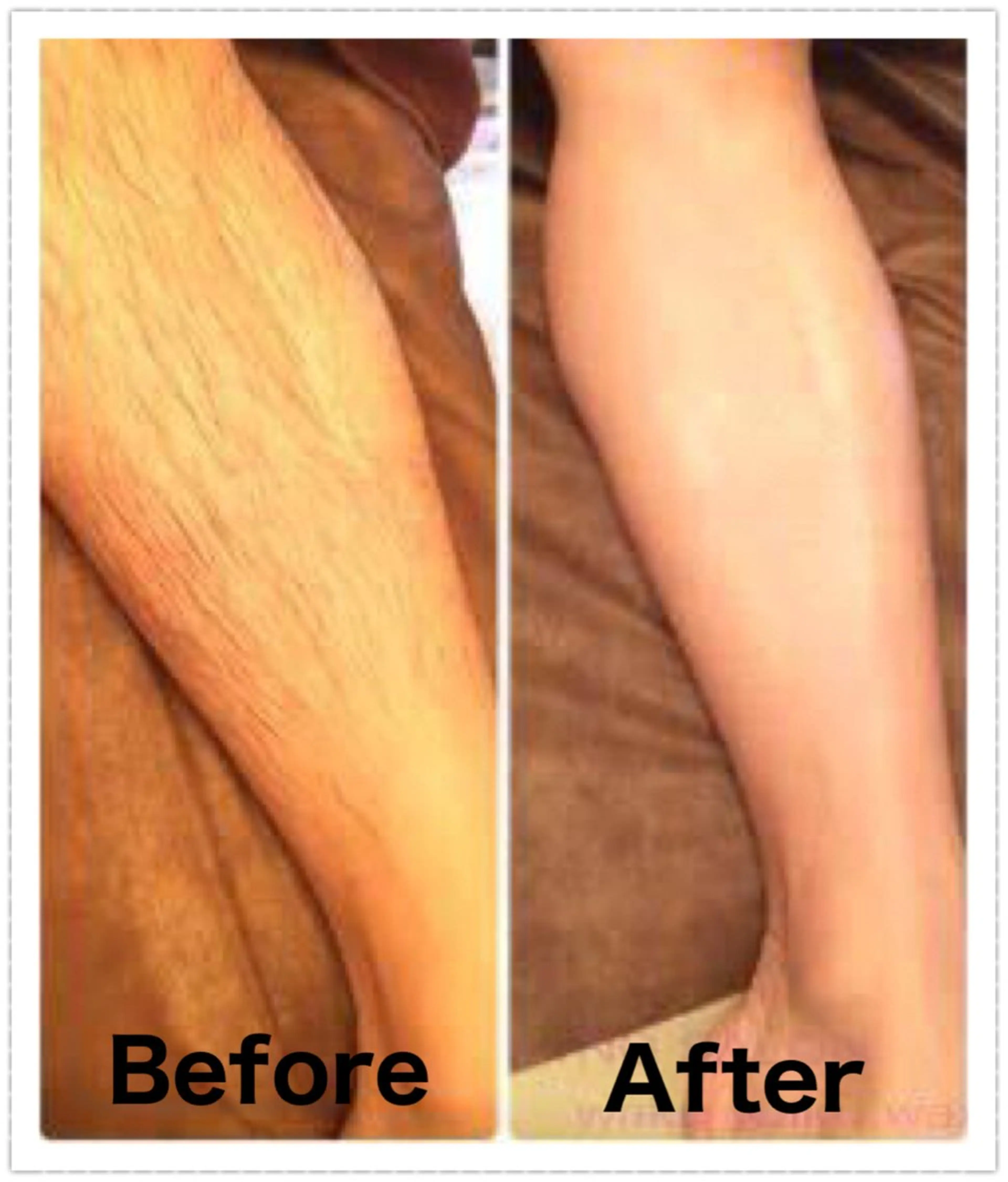 ●脱毛メンズ●【ふくらはぎ＋ひざ下～足首上まで】ワックス脱毛20350⇒¥10450の写真