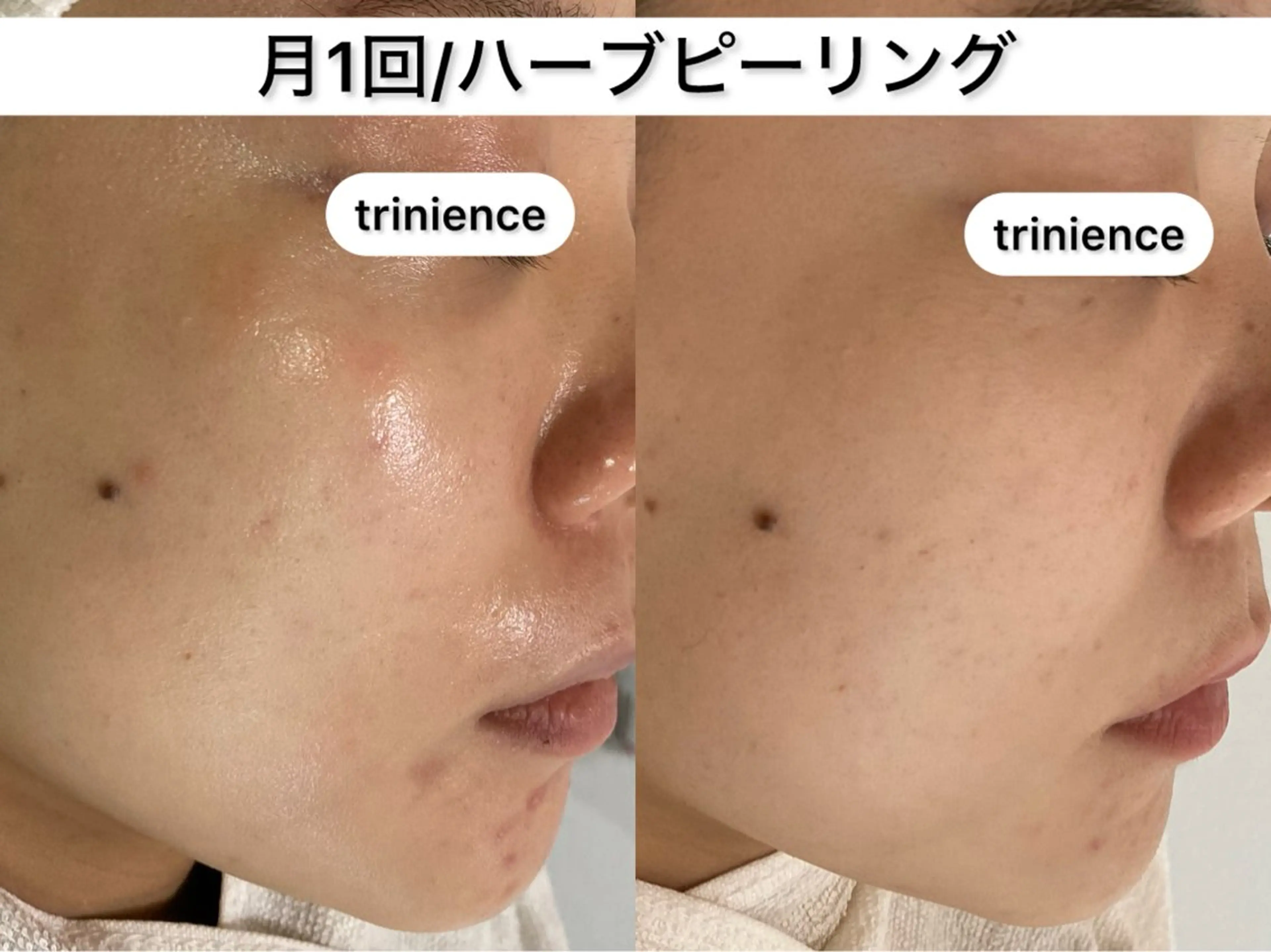TRINIENCE 南流山店のエステ・リラクイメージ