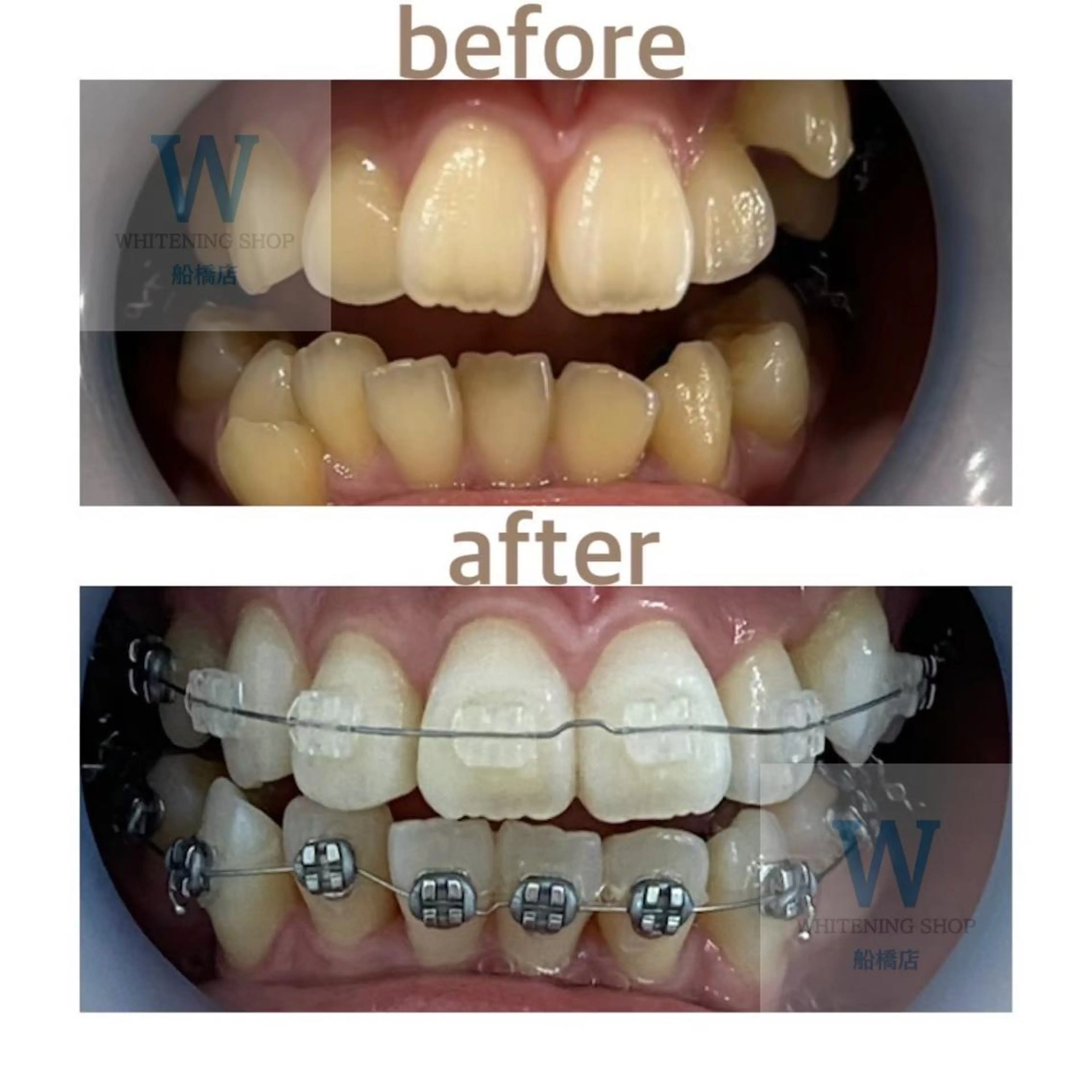 エステ リラク ホワイトニング ショップ船橋２号店のエステ・リラクイメージ