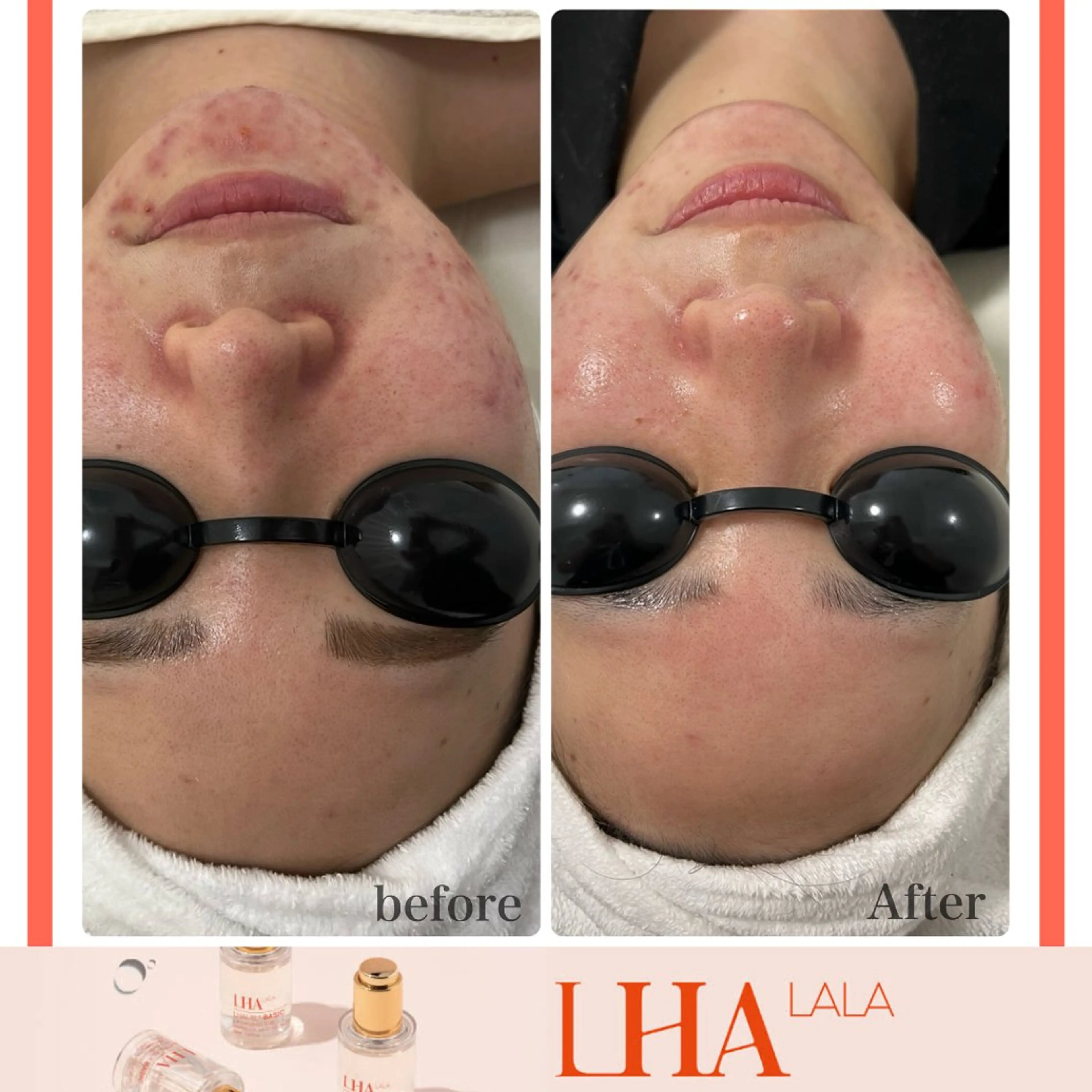 エステ LiAm《美肌管理/ 小顔/脂肪ケア》のその他イメージ