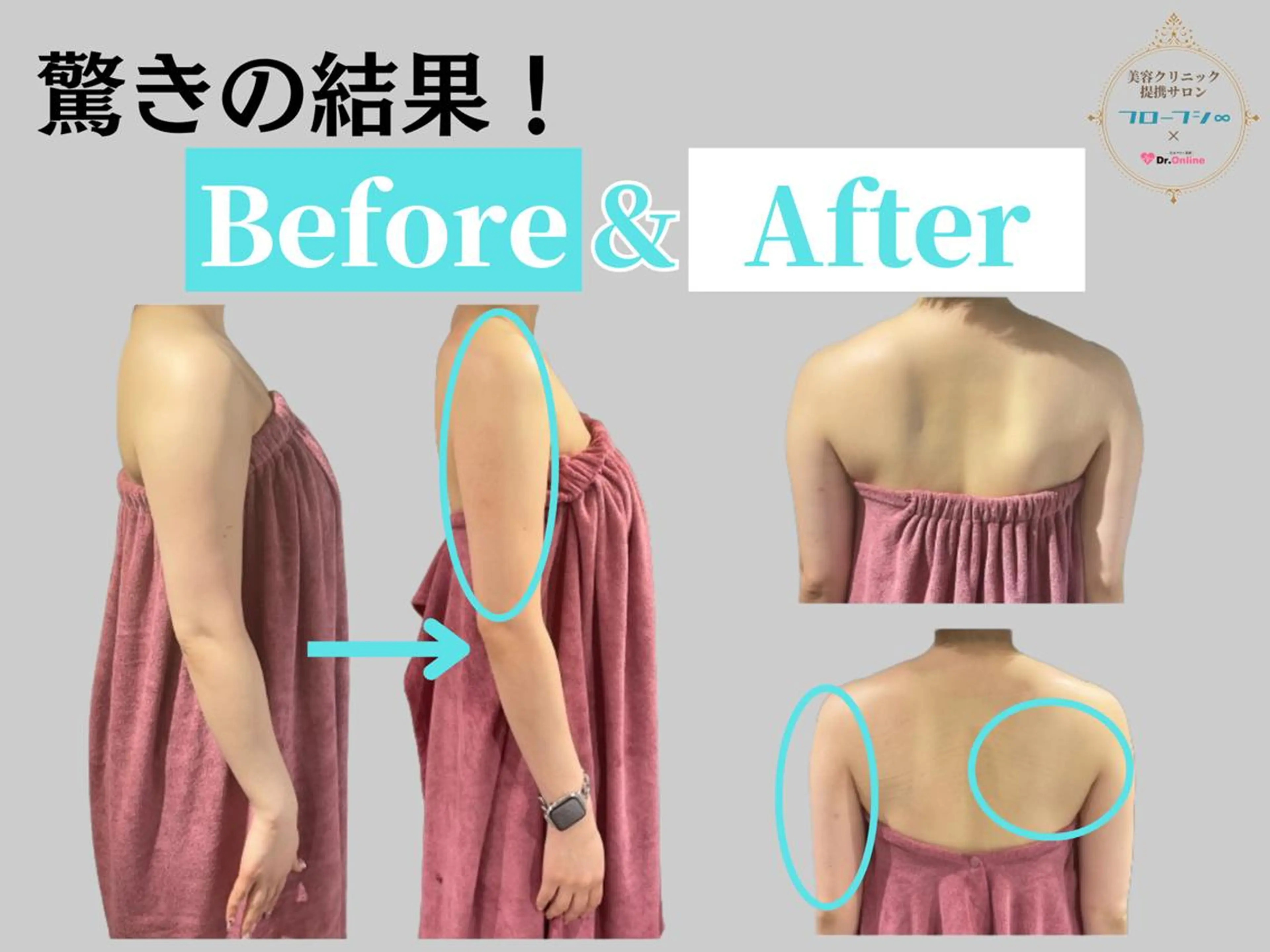 部分痩せ♥️小顔専門 MIKUのエステ・リラクイメージ