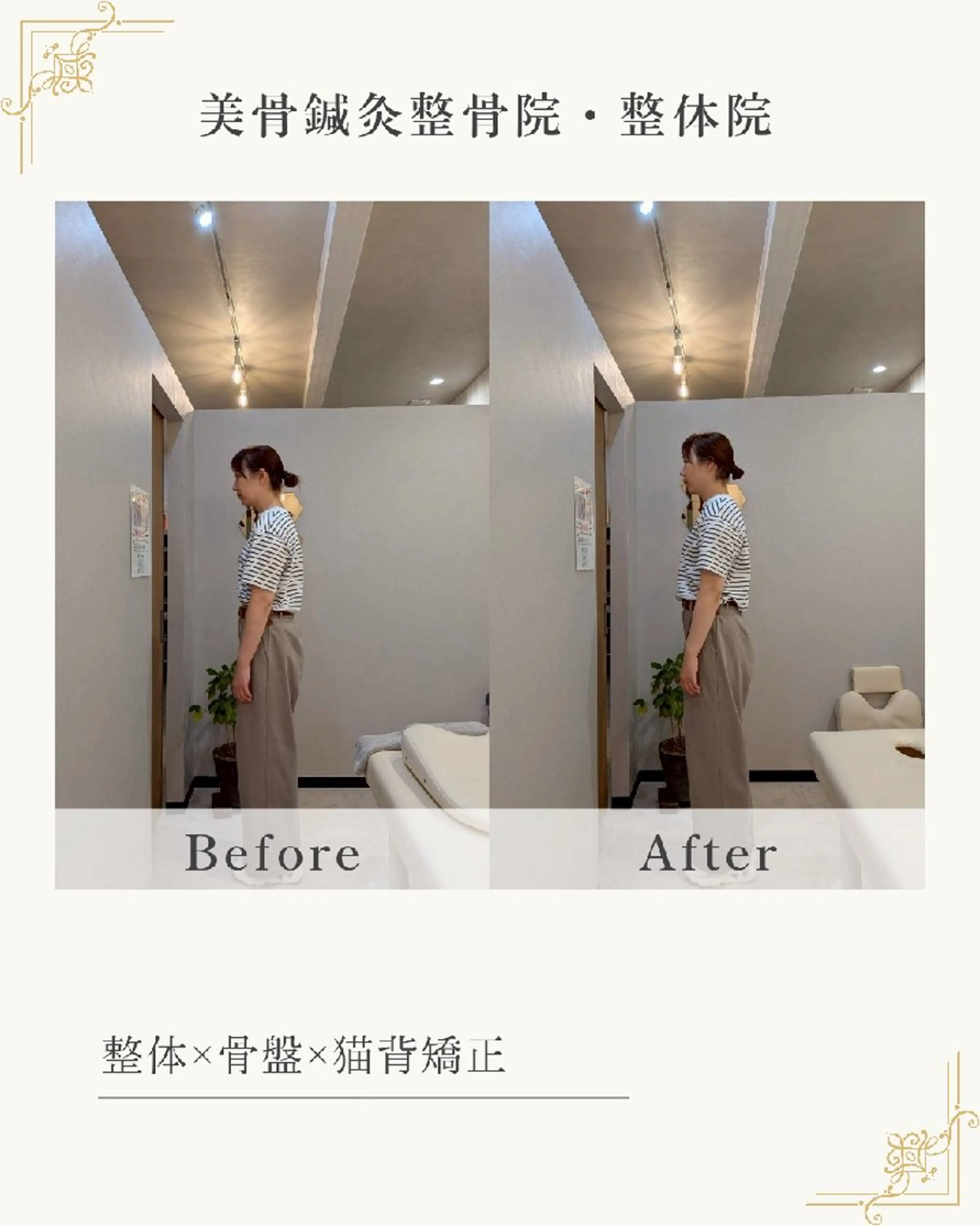 【反り腰▪️姿勢改善】骨盤矯正×姿勢矯正×整体×EMSの写真