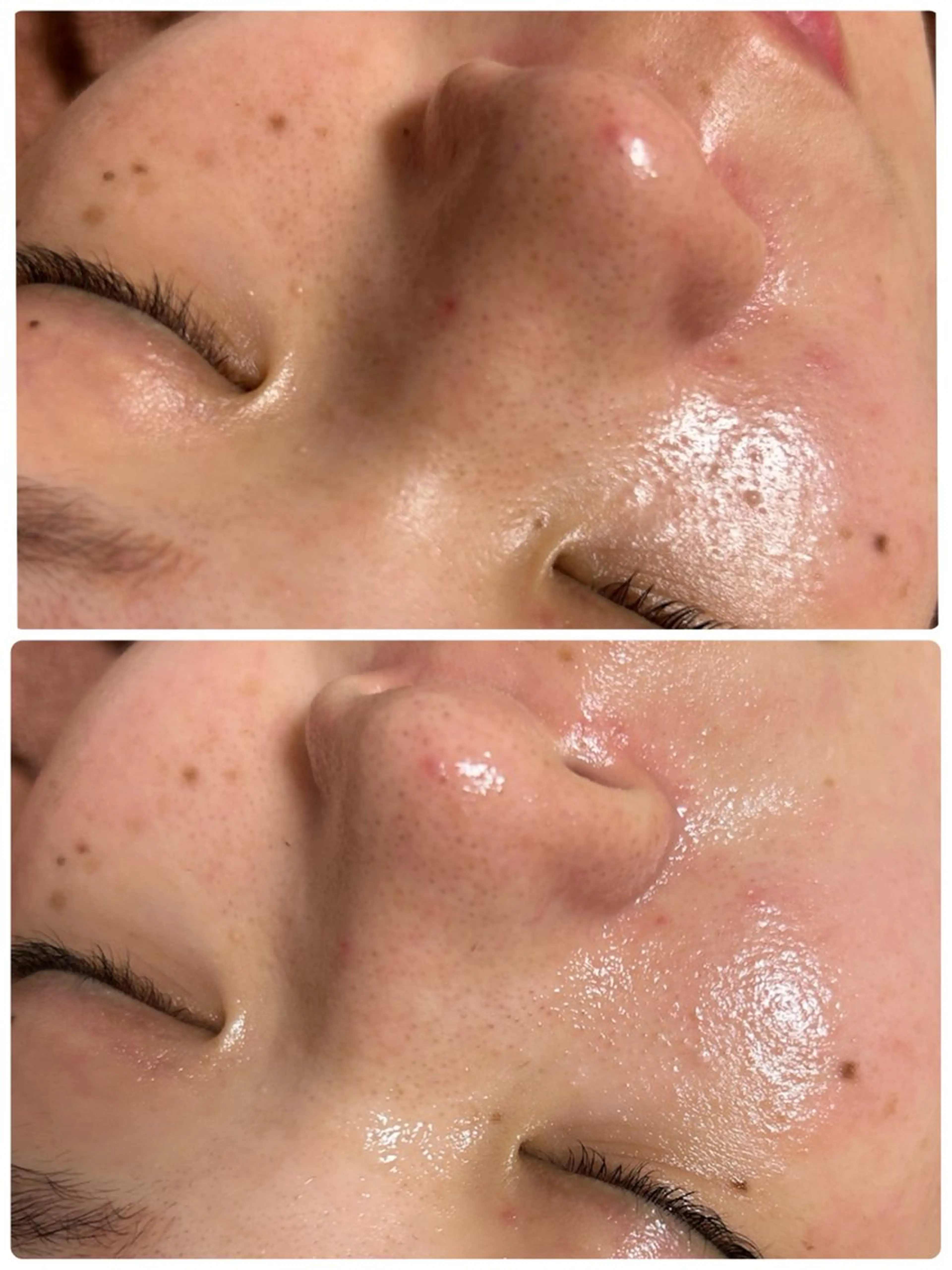 エステ 産毛角質ケア/艶肌 フェイシャルワックスのエステ・リラクイメージ