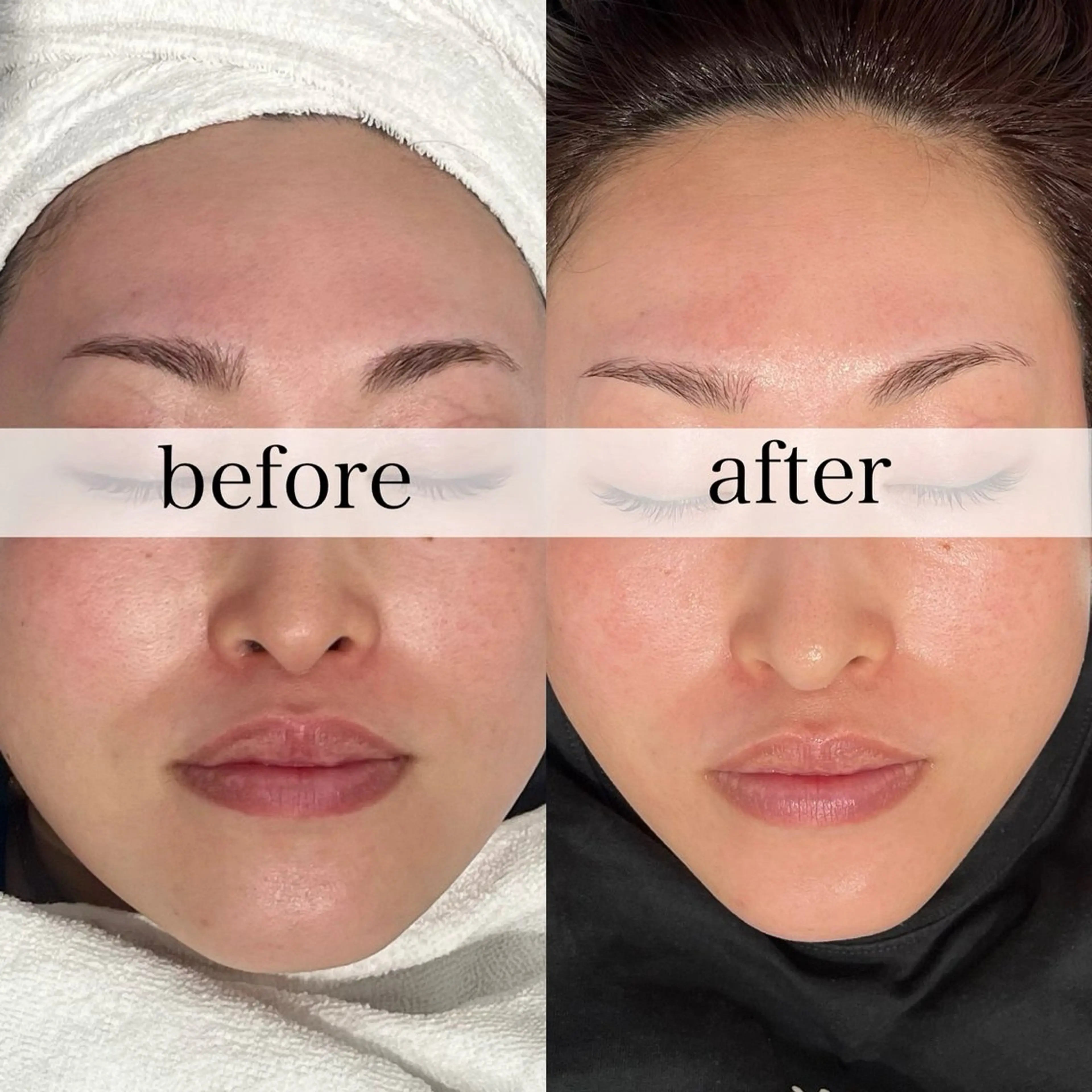 FOXYLASH inoueのエステ・リラクイメージ