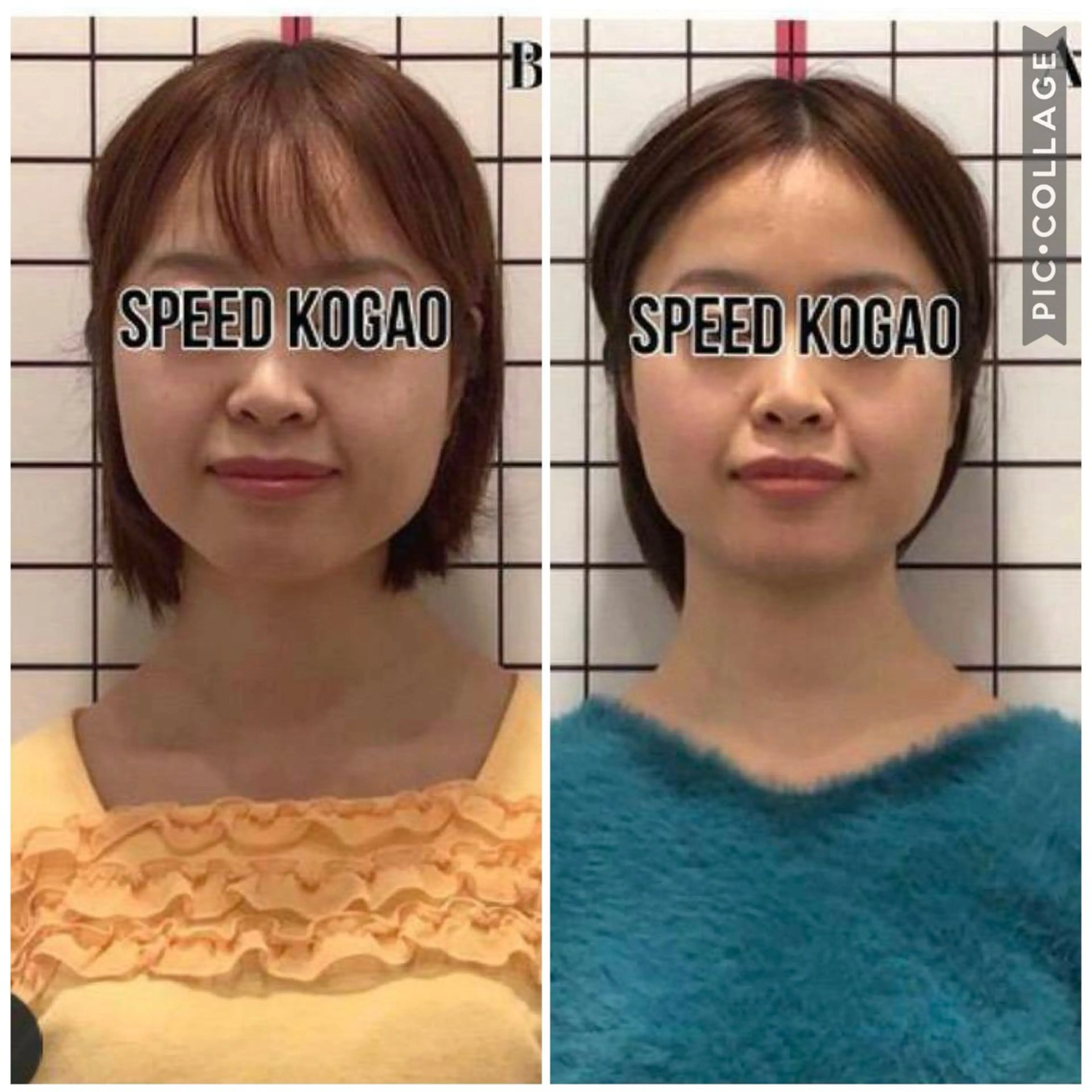 エステ リラク 小顔矯正Speed KOGAO渋谷本店のエステ・リラクイメージ