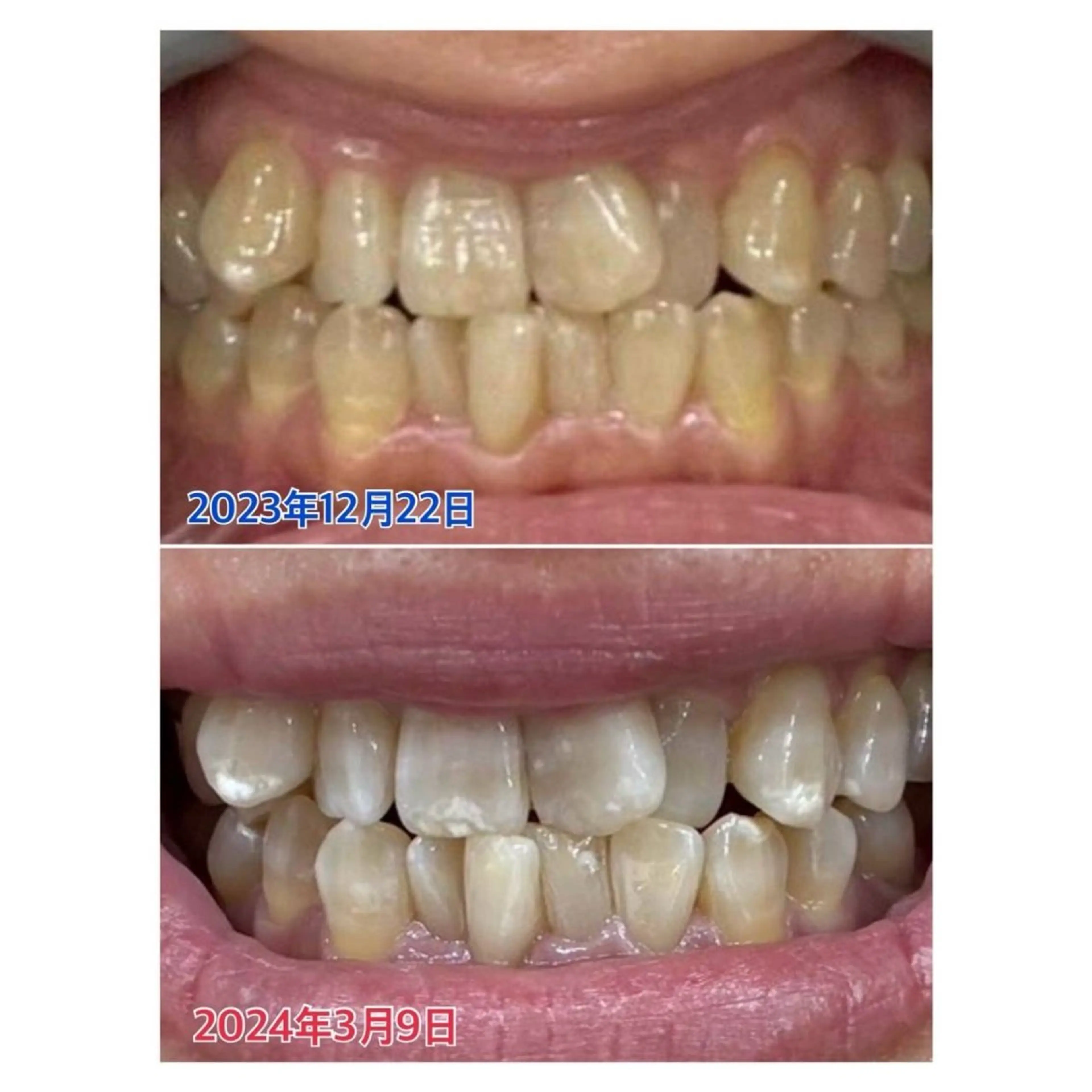 Melty 輝のその他イメージ