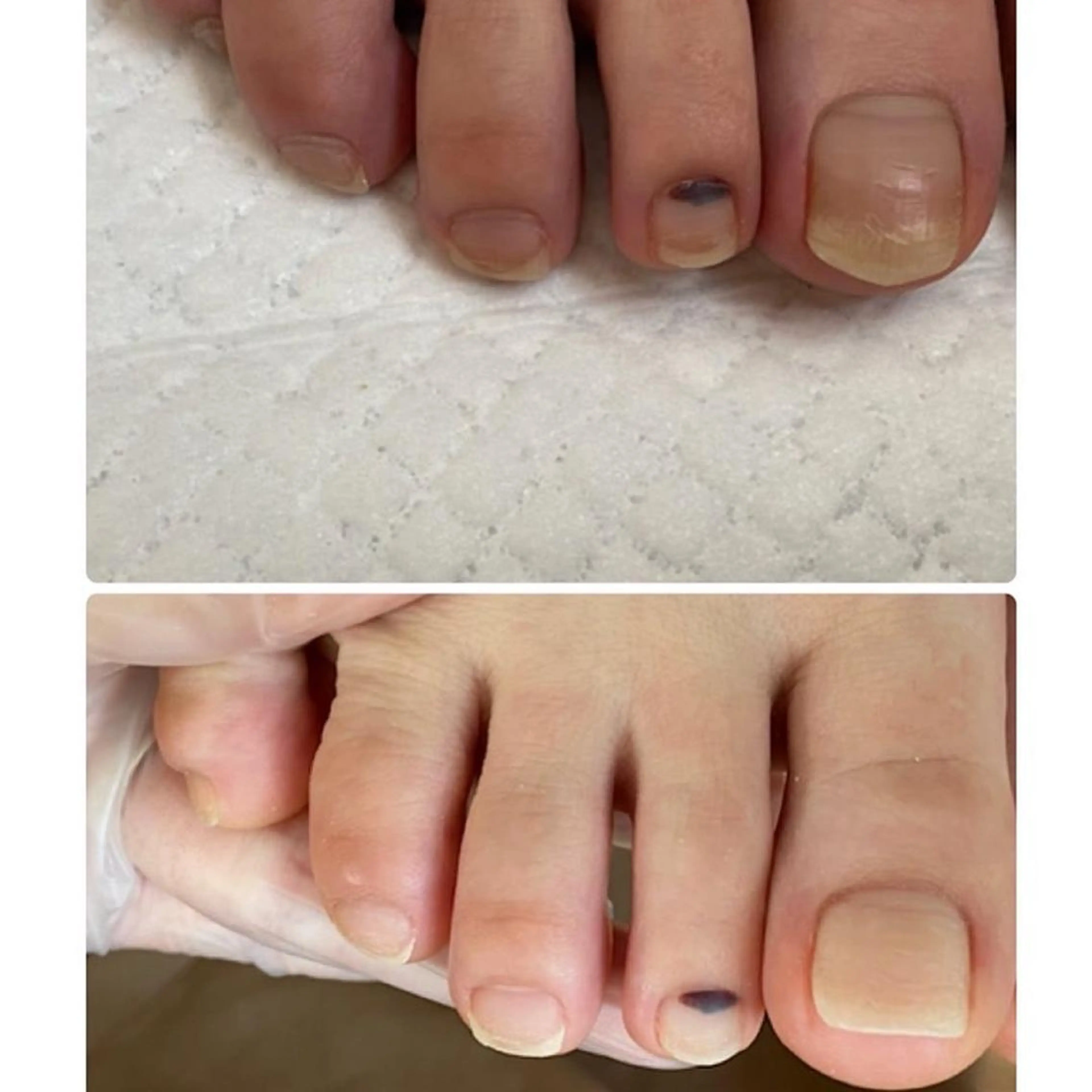 ネイル フットネイル その他(ネイル) and M. nailのネイルデザイン