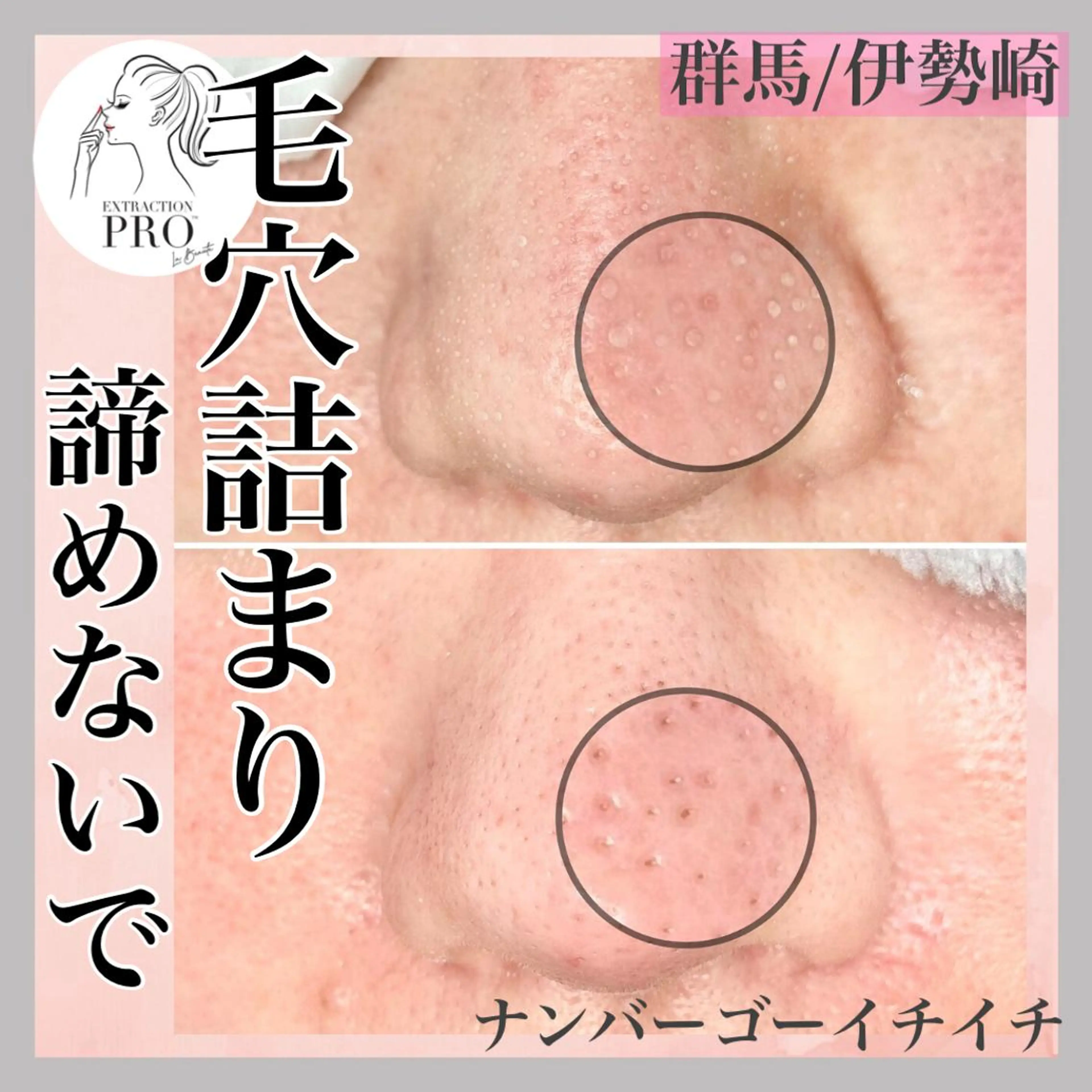 脱毛&フェイシャル NO.511のエステ・リラクイメージ