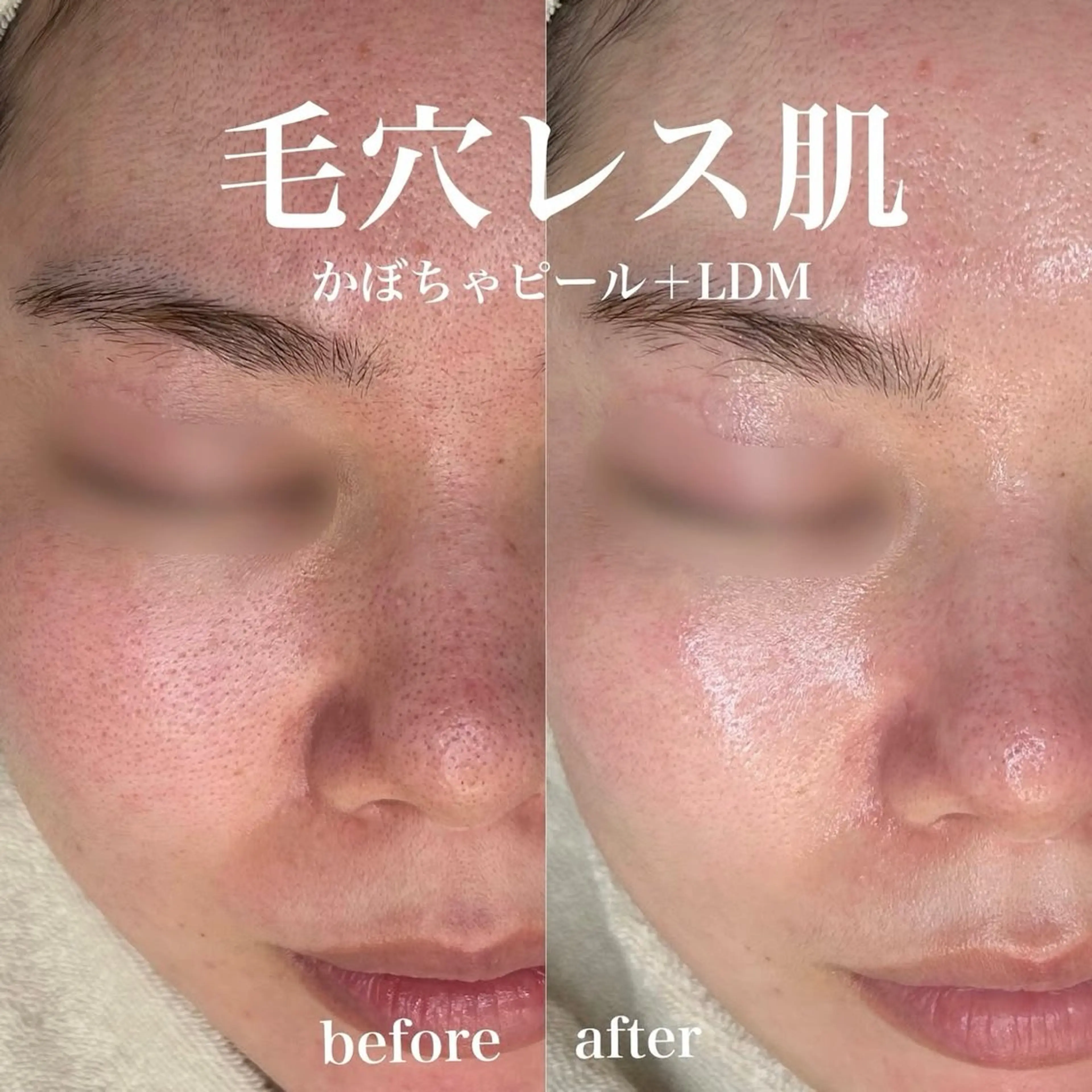 韓国肌管理&小顔 ＩＲＯＨＡのエステ・リラクイメージ