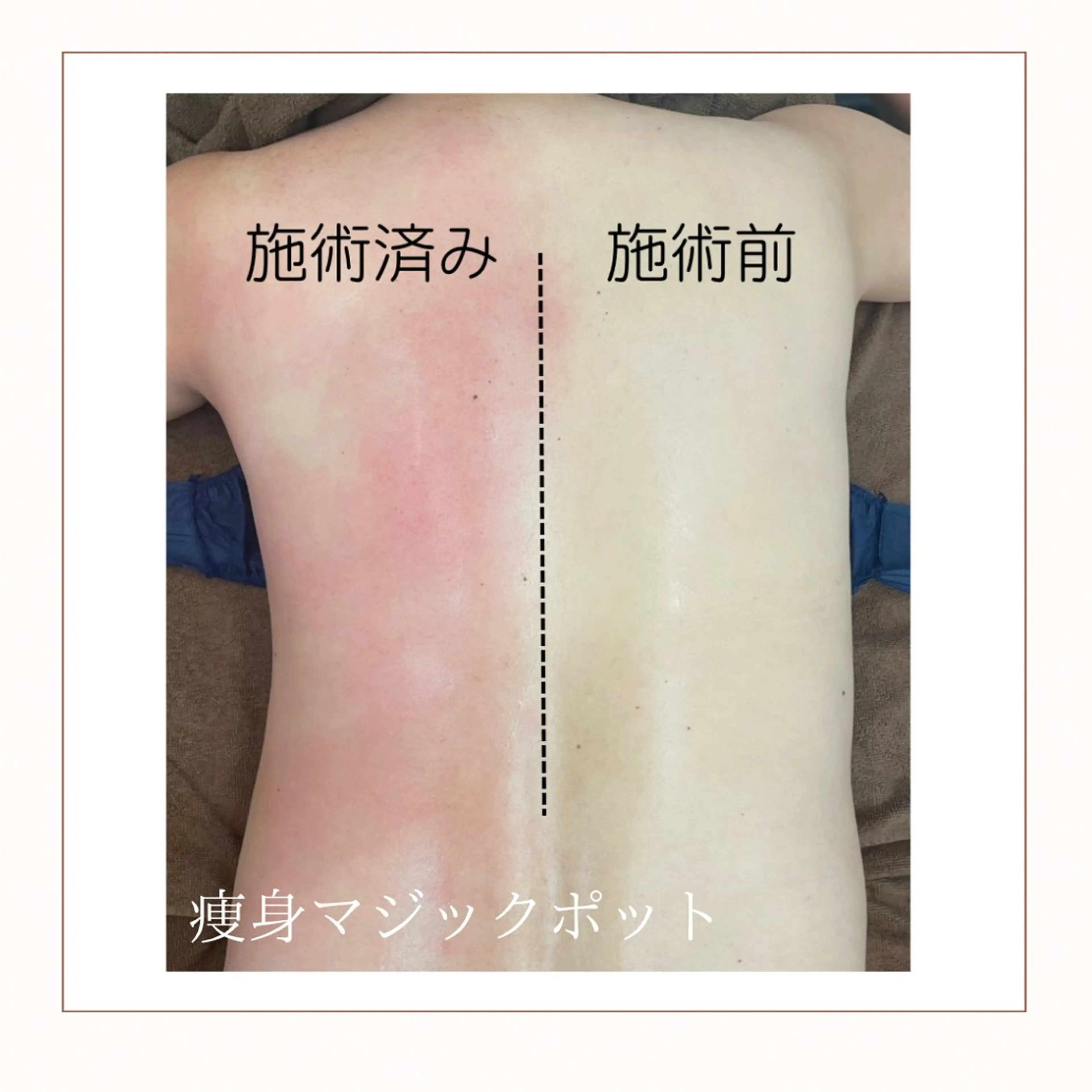 【本気痩せ！全身燃焼コース】温活×痩身🔥よもぎ蒸し30分＋マジックポット全身120分の写真