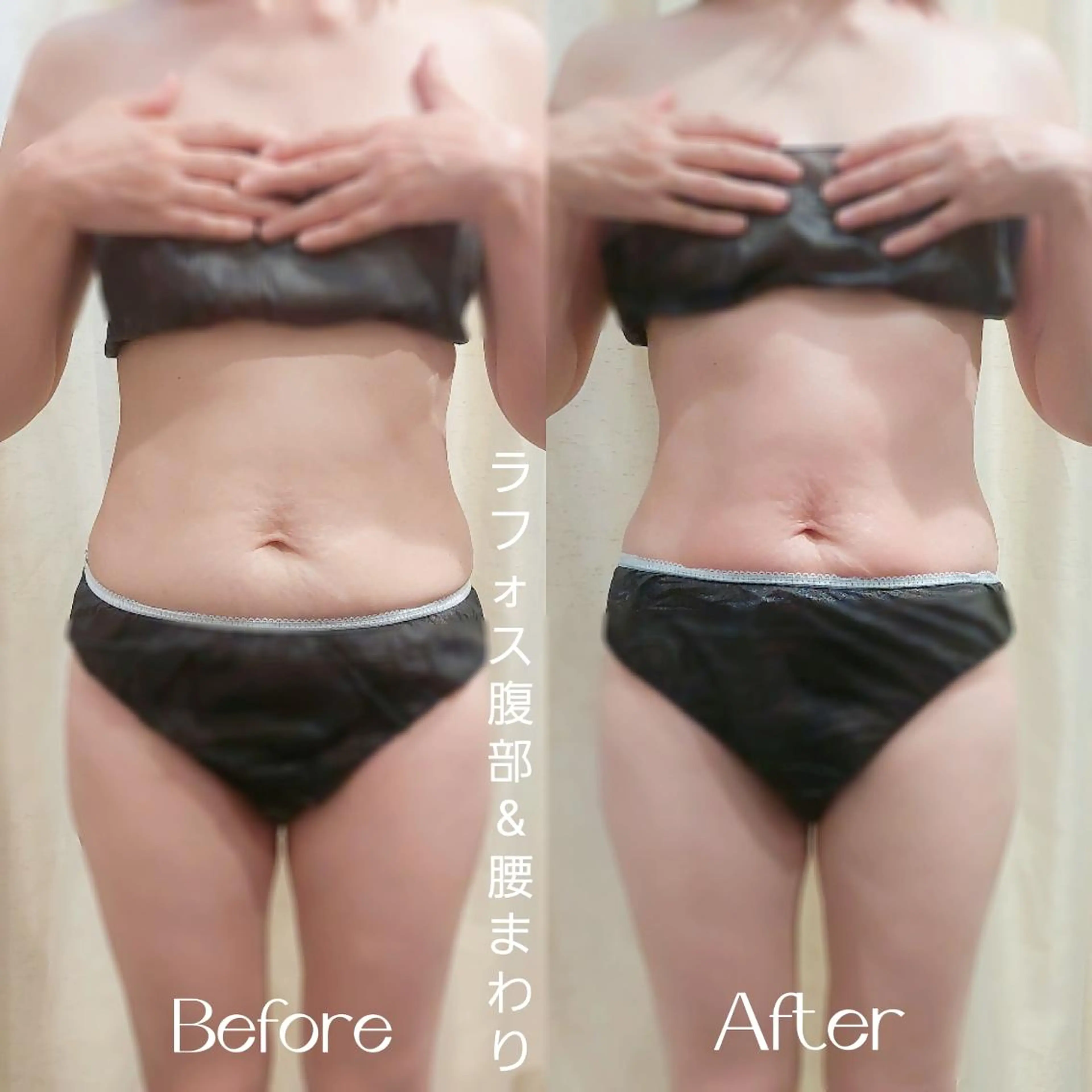 エステ リラク MyFairLady miuのエステ・リラクイメージ