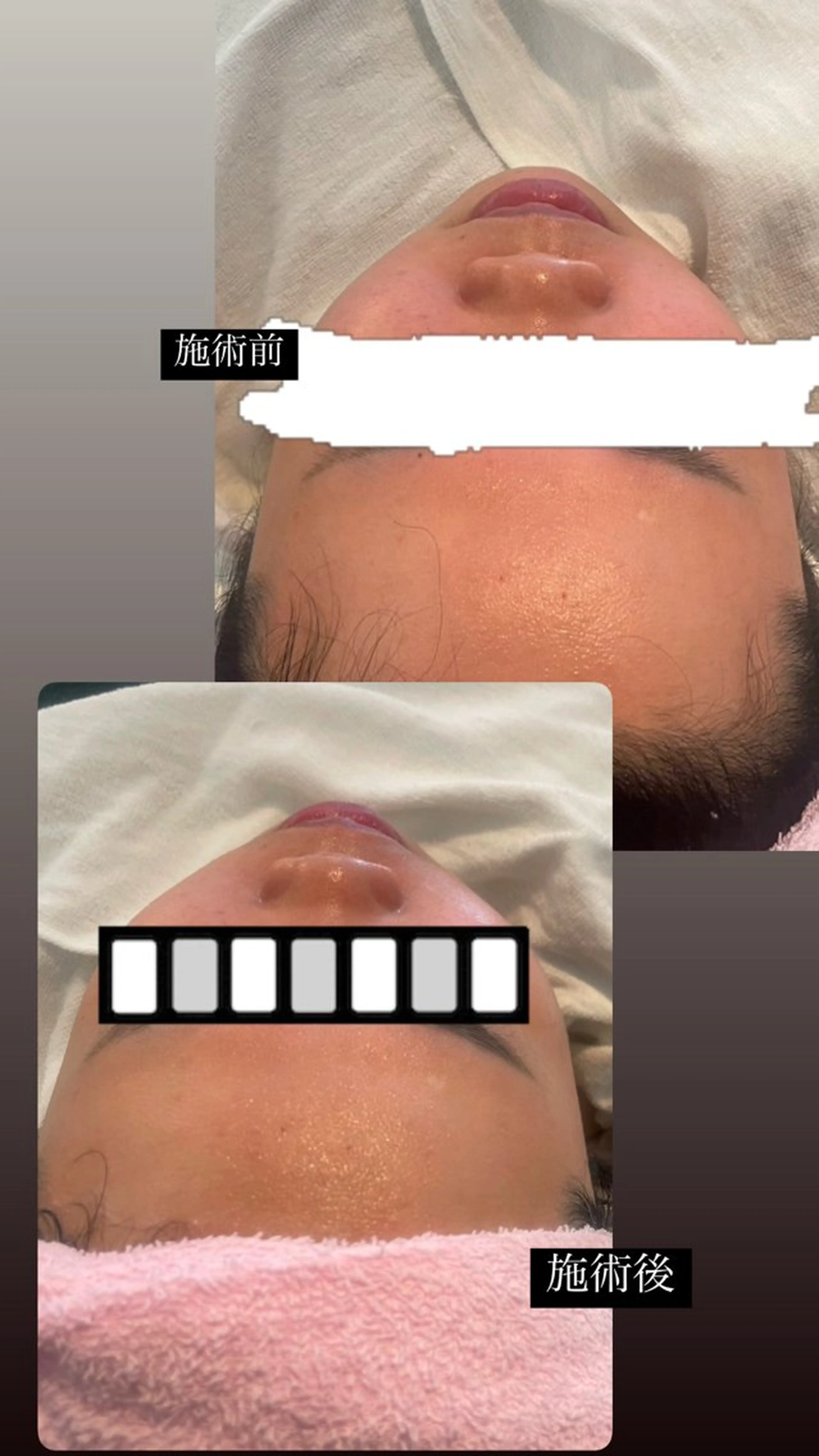 代謝アップ，浮腫み， 体質改善のエステ・リラクイメージ