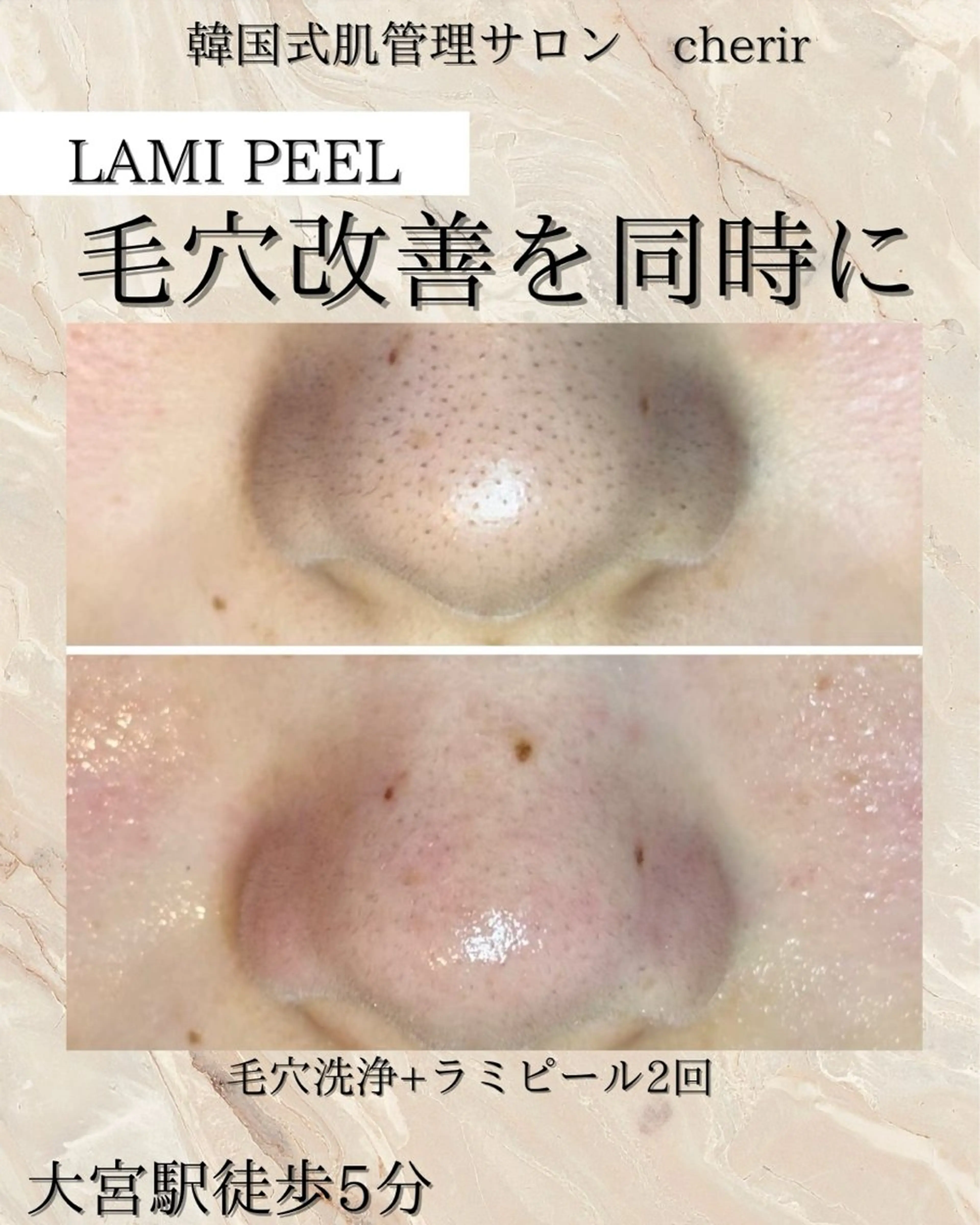 cherir大井町/ 毛穴ニキビ改善専門のエステ・リラクイメージ