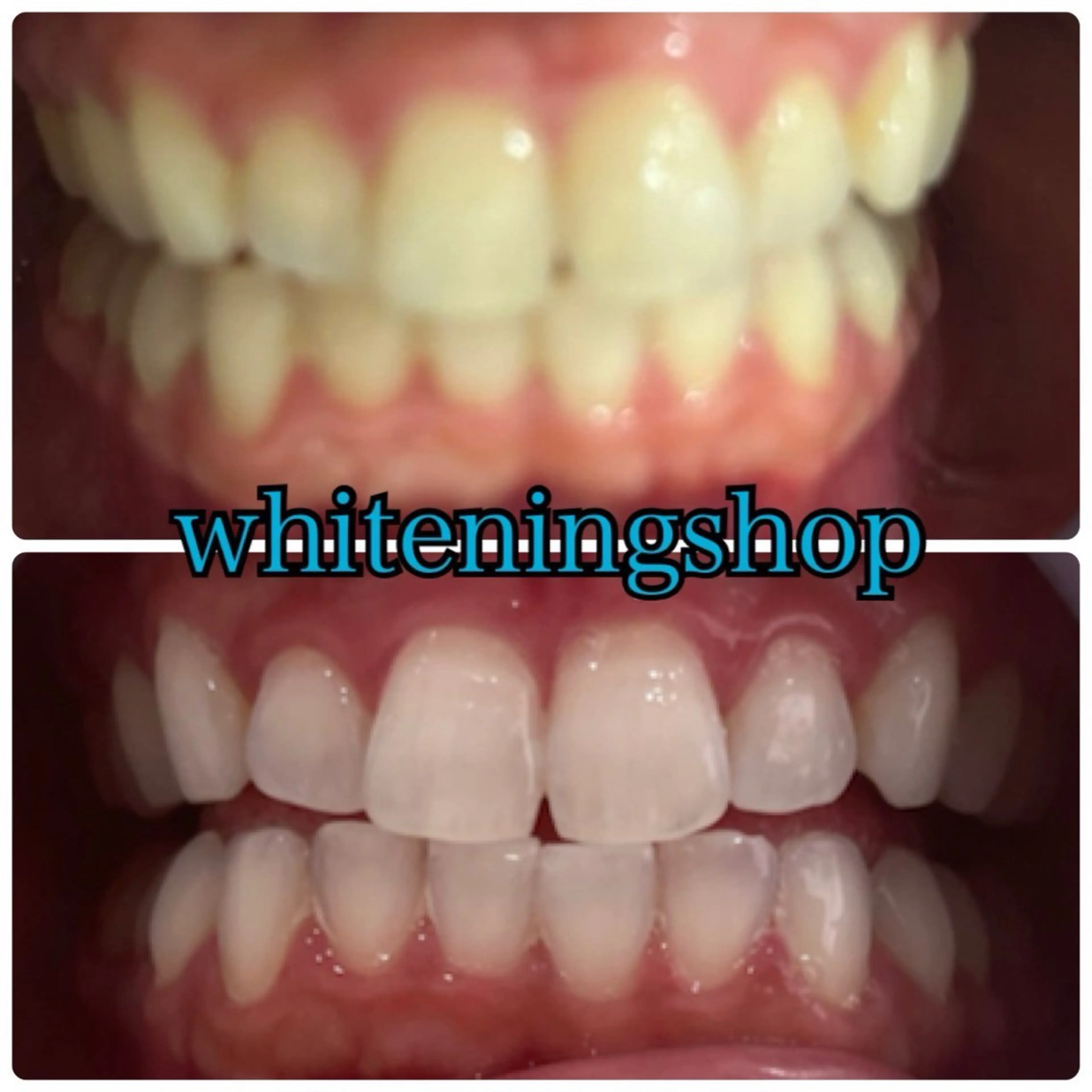 メンズ エステ リラク ホワイトニング ショップ川越店のエステ・リラクイメージ