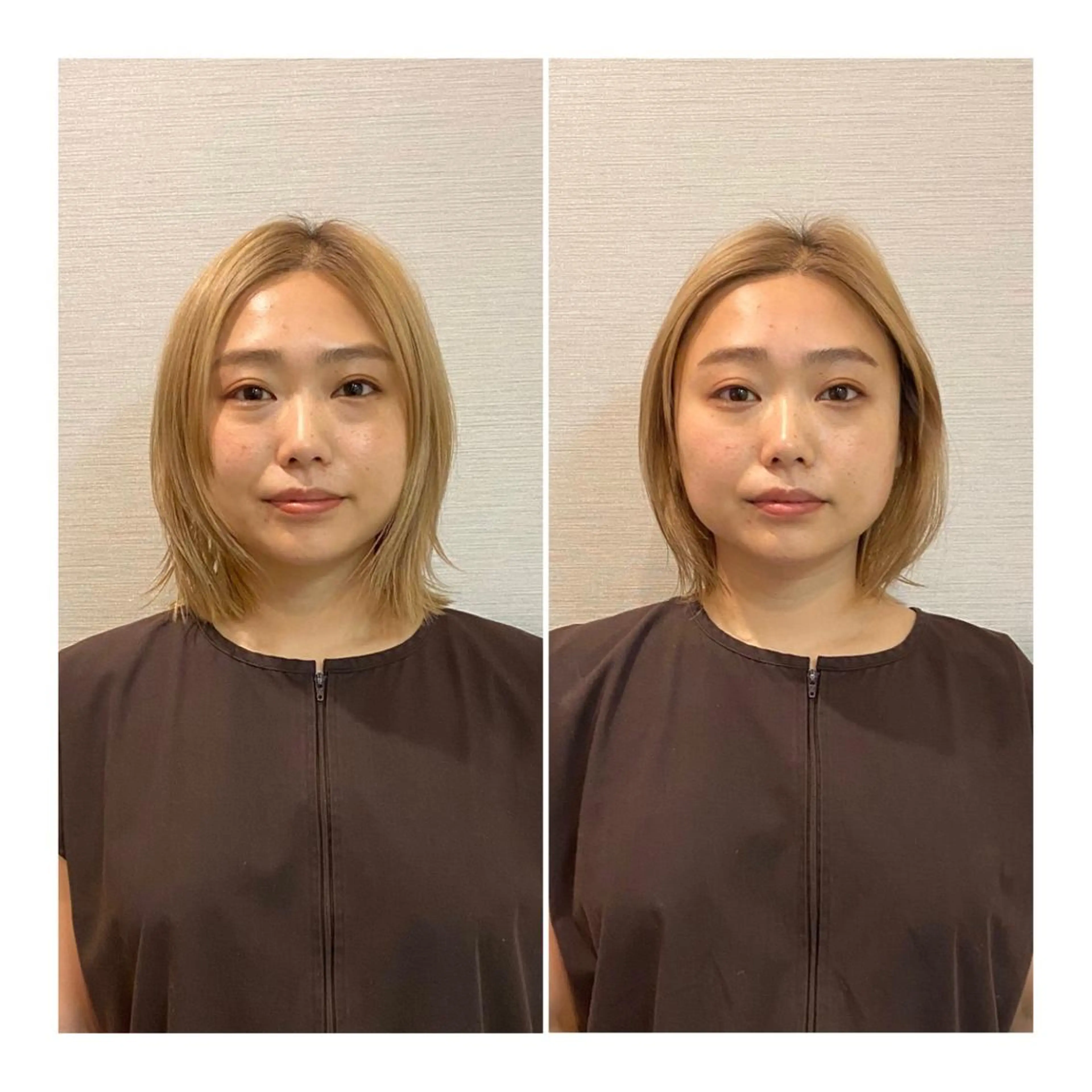 その他 即小顔♥️美容鍼× ハーブピーリングのその他イメージ