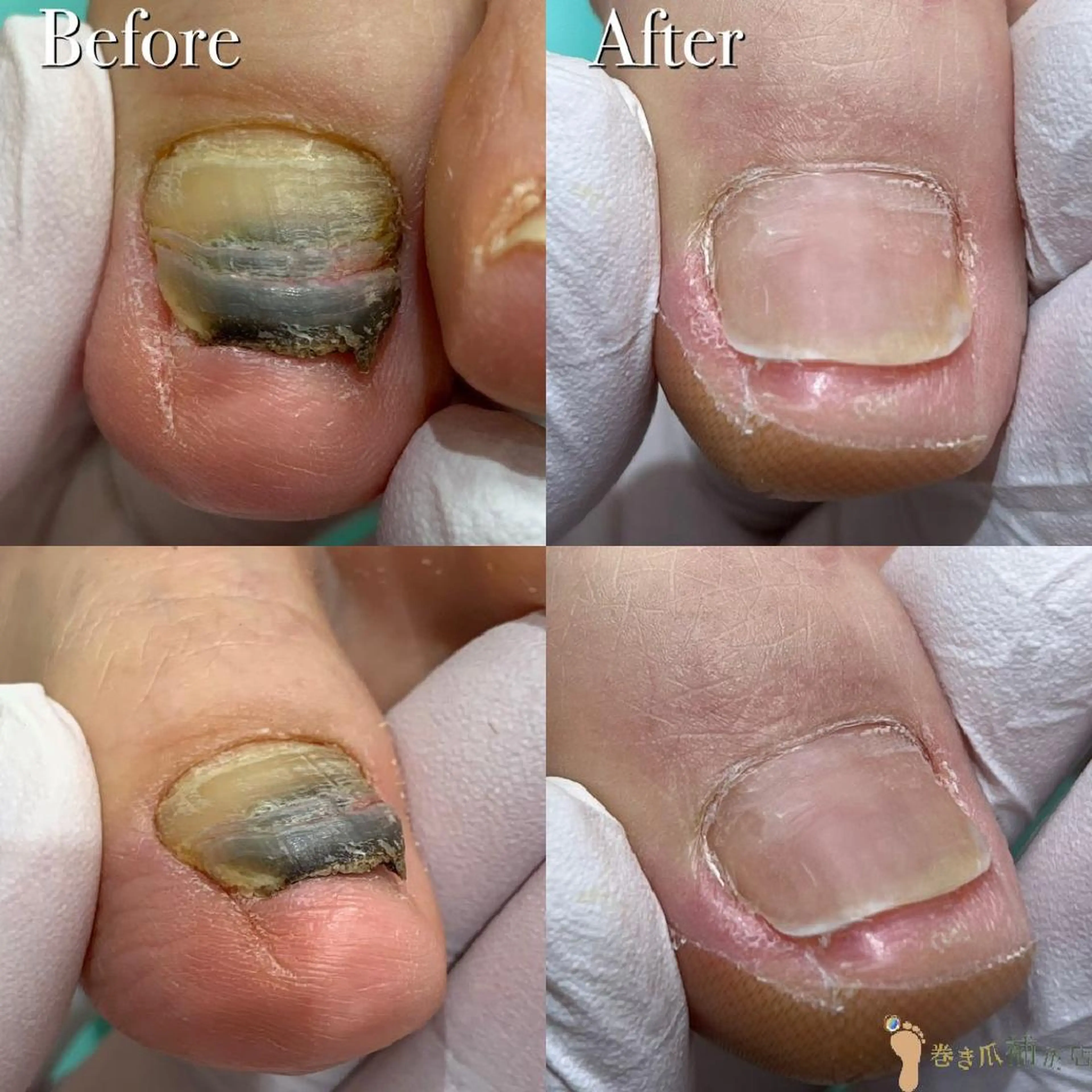 東京巻き爪アカデミー所属・東京巻き爪 アカデミーのエステ・リラクイメージ