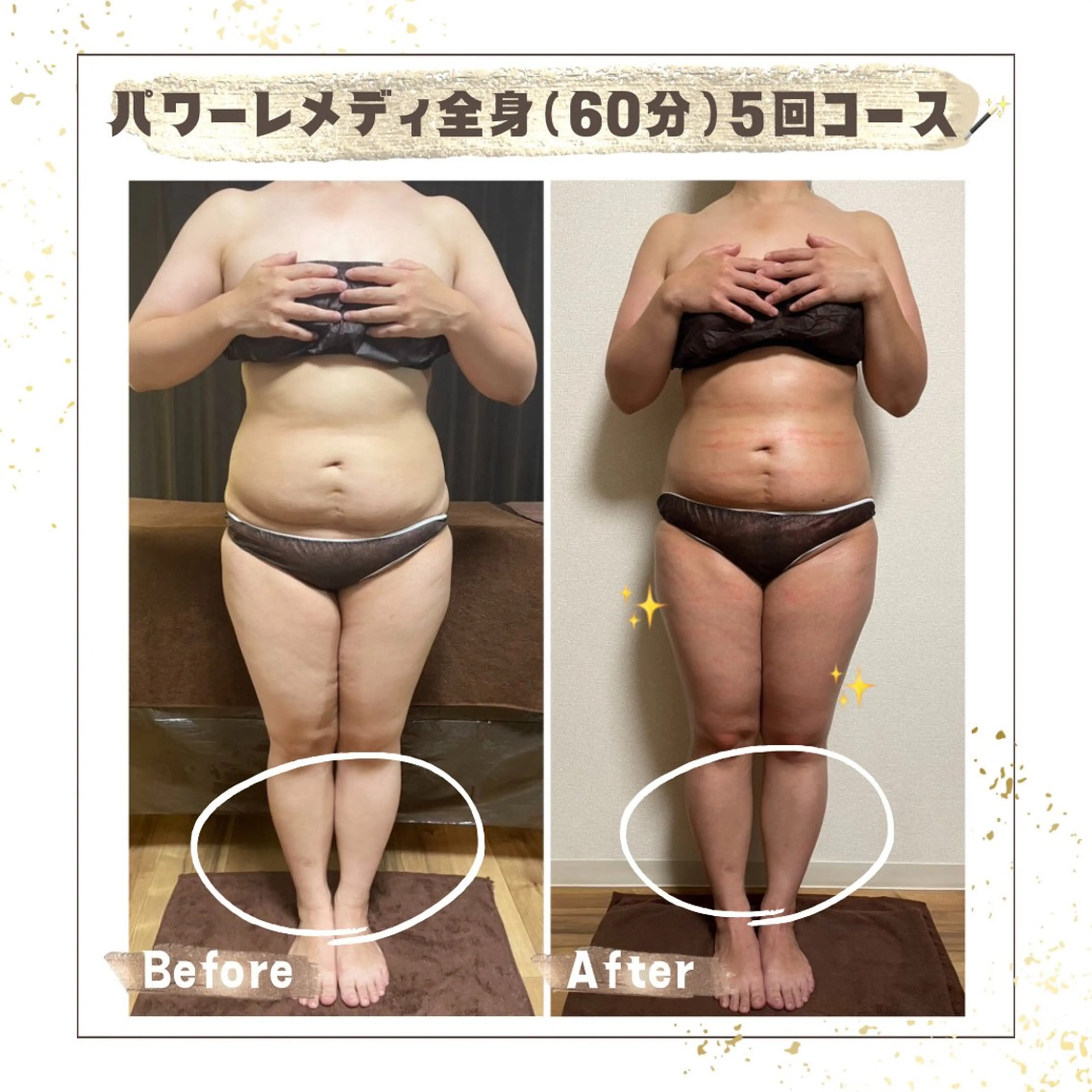 エステ リラク Luca所属・Luca 痩身• 疲労改善×韓国肌管理のエステ・リラクイメージ