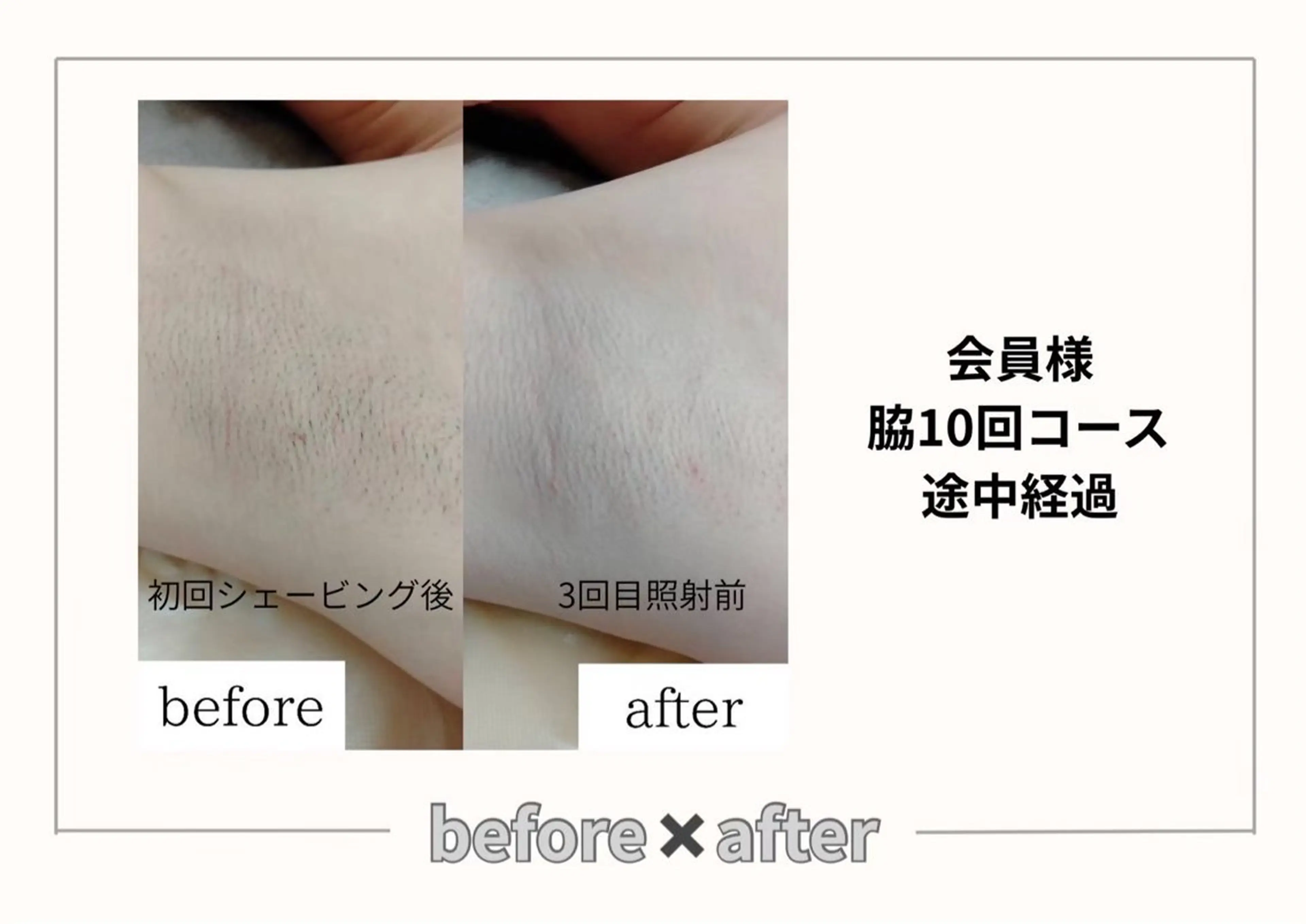 みんなの脱毛ツルリン ☀️船橋店☀️のエステ・リラクイメージ