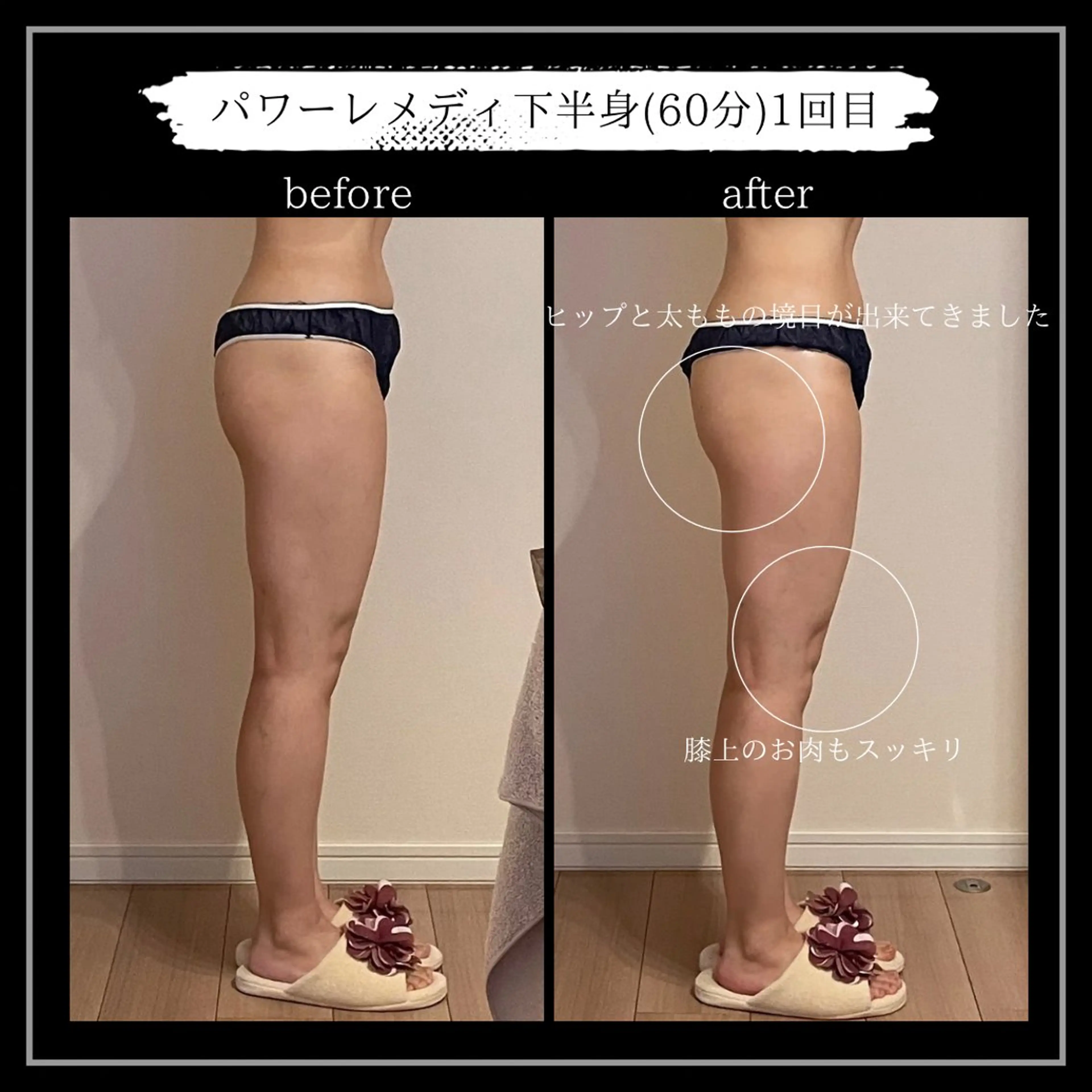 オフ:オン 全身筋膜マッサージのエステ・リラクイメージ