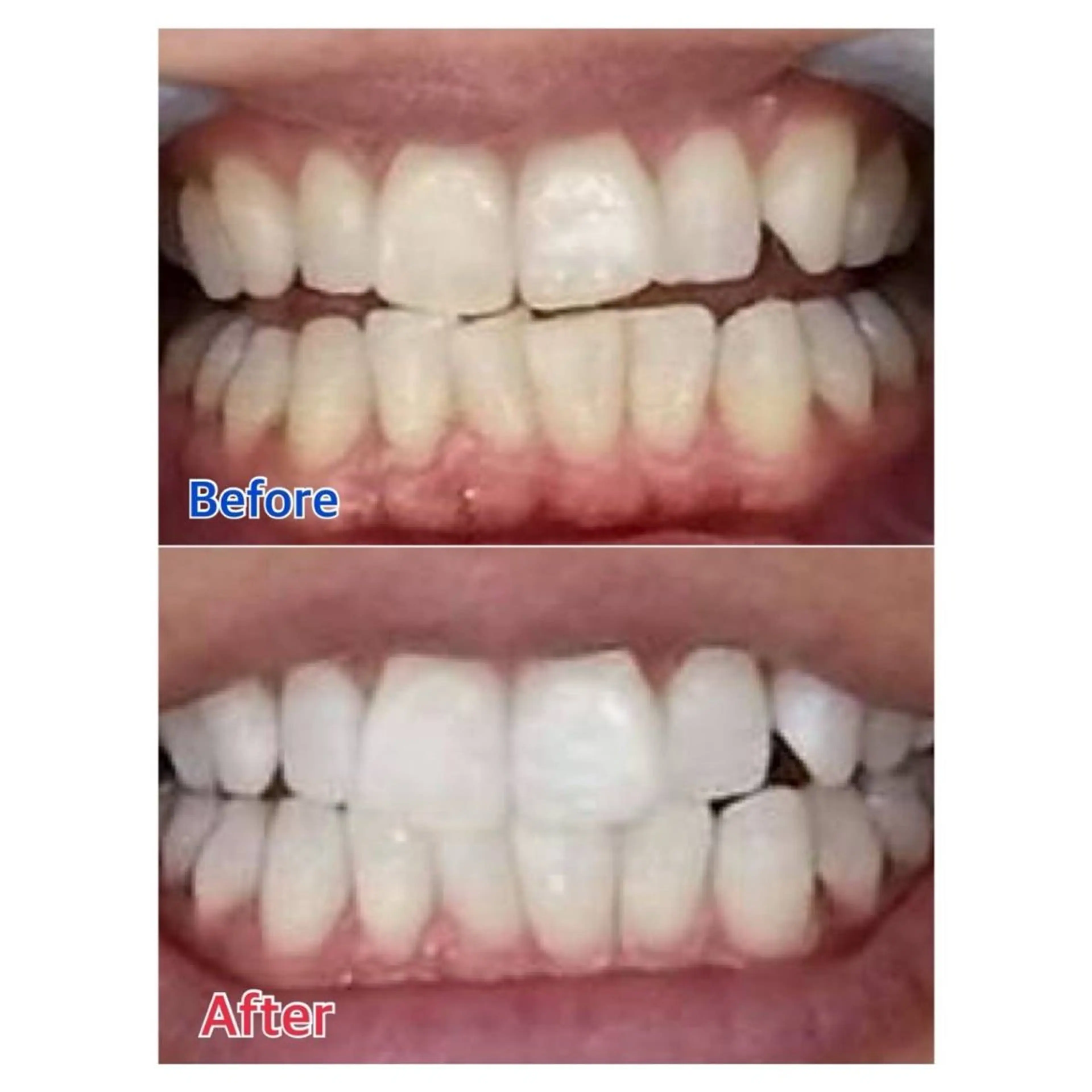 Melty 輝のその他イメージ