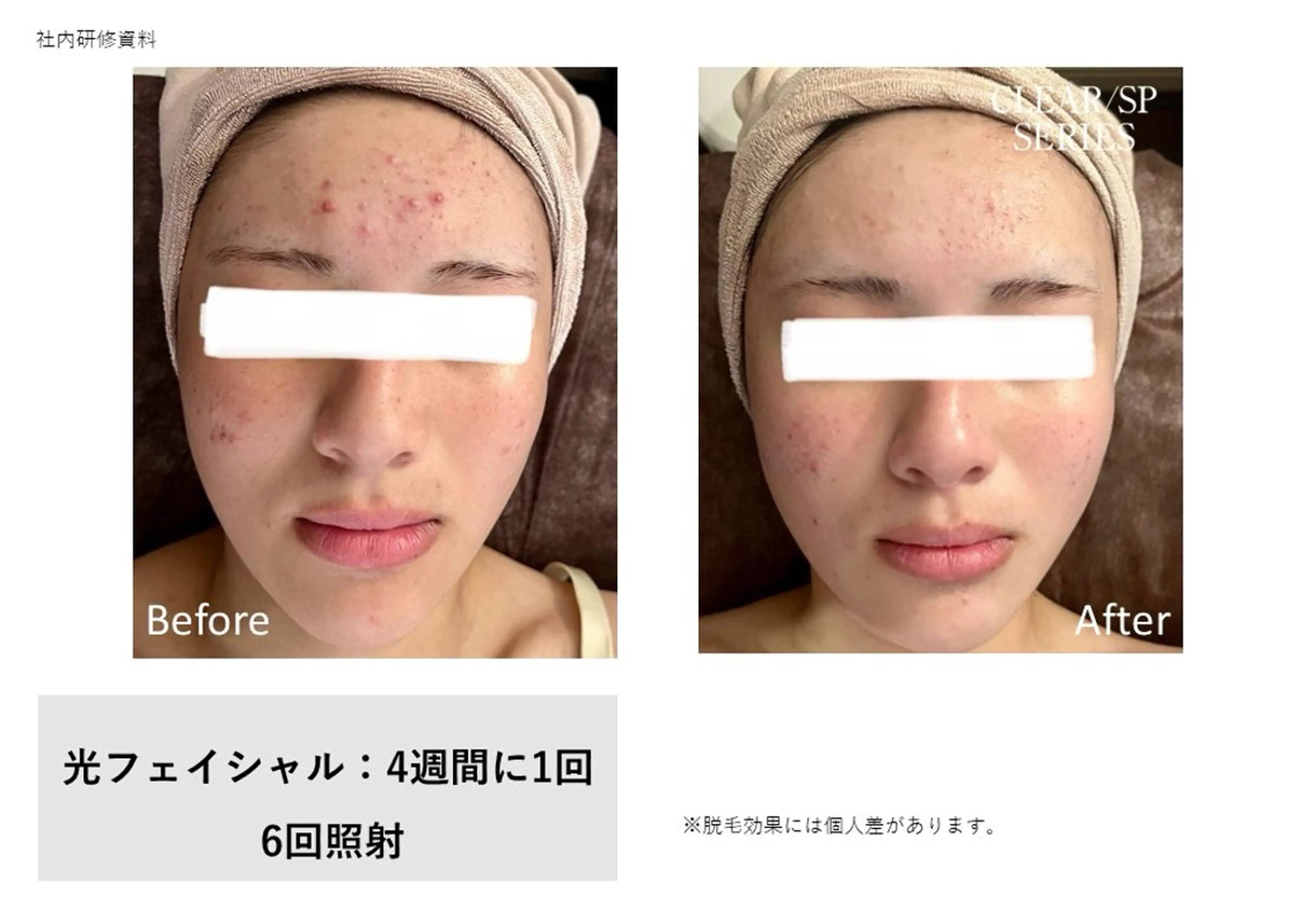 エステ 野口 茂宰のヘアスタイル