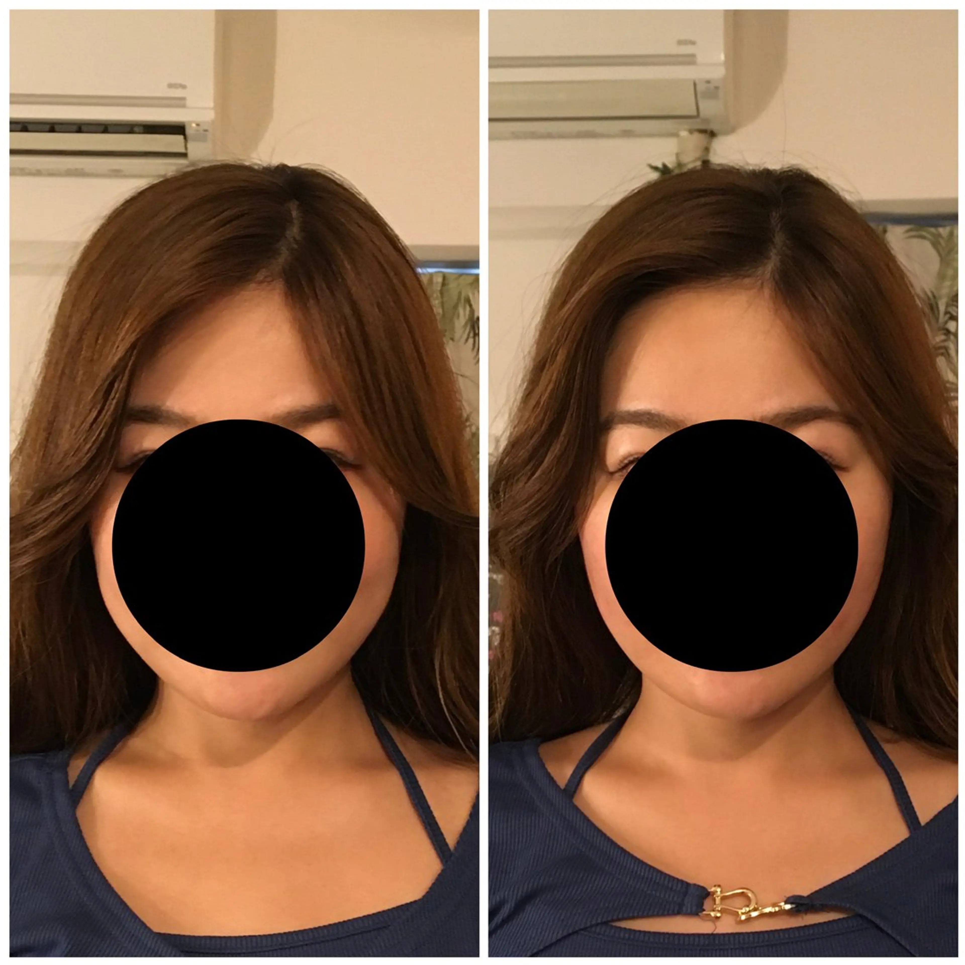 鍼灸salon mのエステ・リラクイメージ