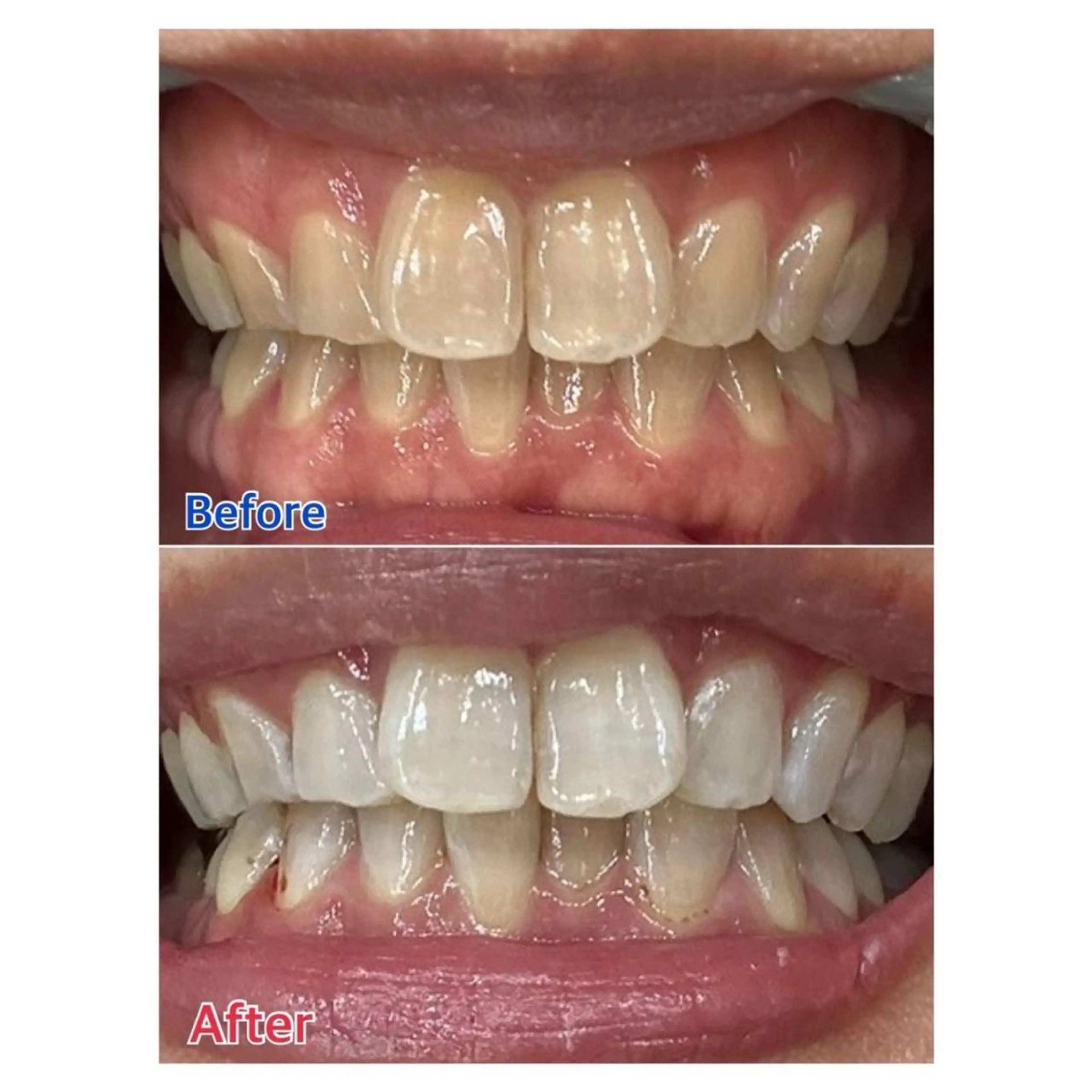 Melty 輝のその他イメージ