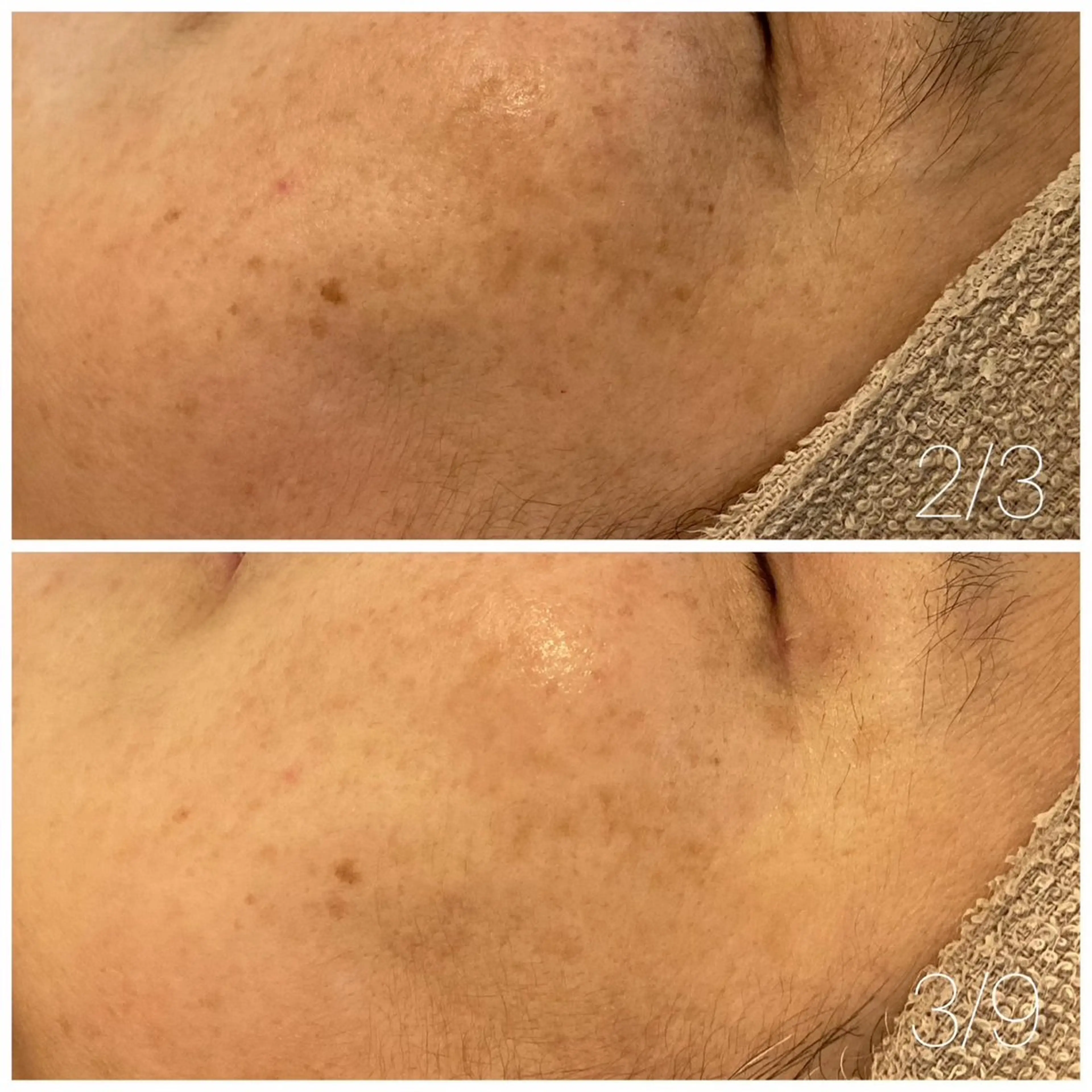 エステ Lassy Yuriの眉毛・アイブロウイメージ