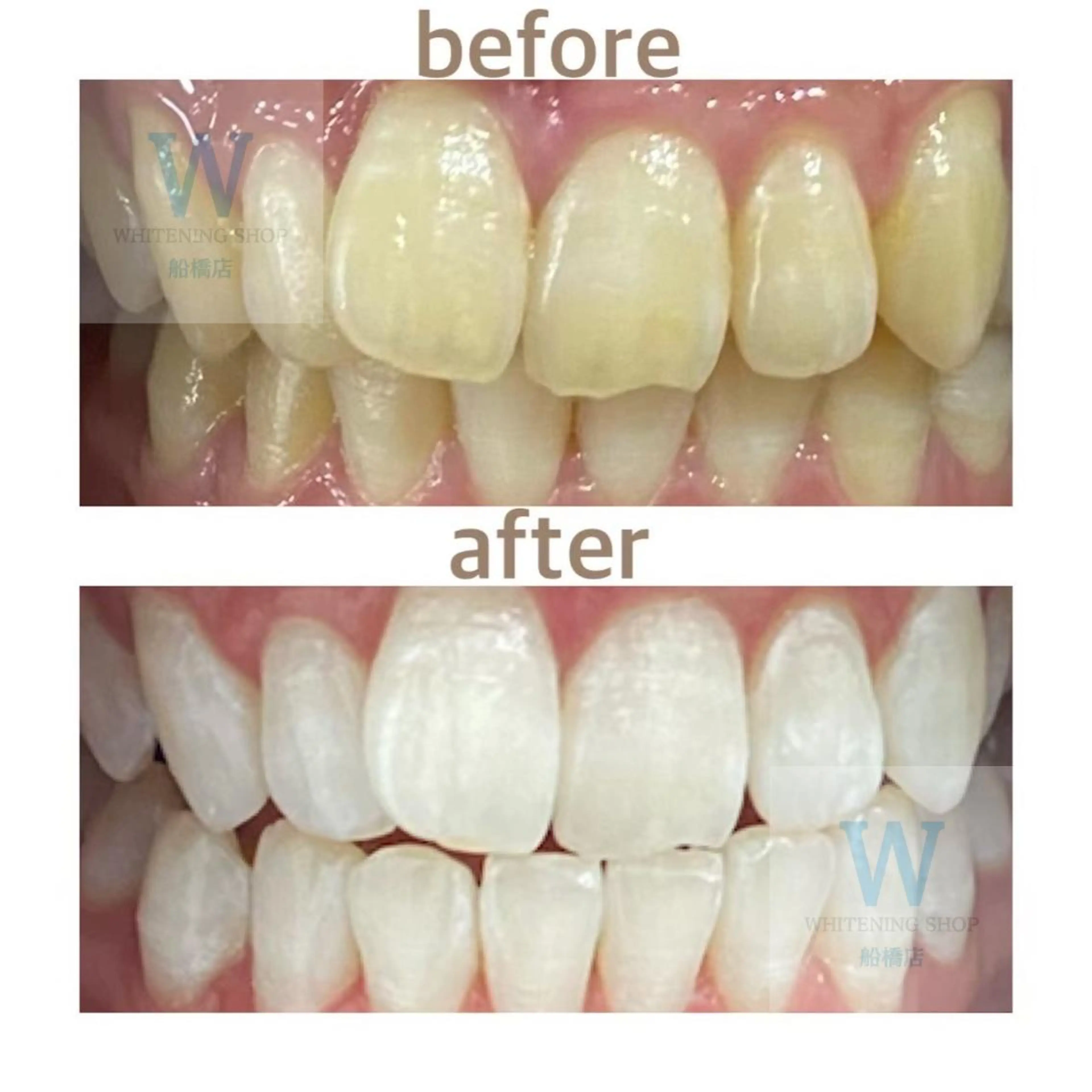 エステ リラク ホワイトニング ショップ船橋２号店のエステ・リラクイメージ